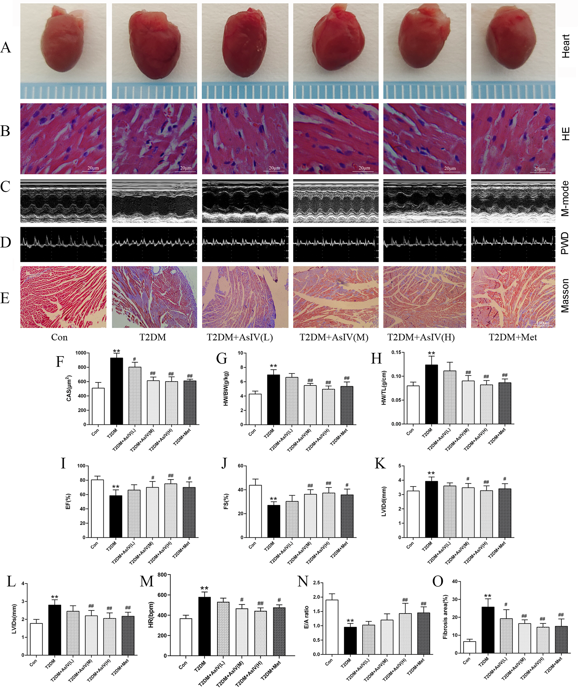 Five panels display various analyses of heart tissue from different treatment groups: A) physical appearance of hearts; B) HE-stained tissue sections; C) M-mode echocardiograms; D) Pulse Wave Doppler; E) Masson-stained sections. Bar charts (F-O) compare measures like cardiomyocyte cross-sectional area, heart weight, ejection fraction, and fibrosis levels across control (Con), Type 2 Diabetes Mellitus (T2DM), and four treatment groups with Asiaticoside IV (low, medium, high) and Metformin. Measurements include CAS, HW/BW, LVIDd, FS, HR, and E/A ratio.