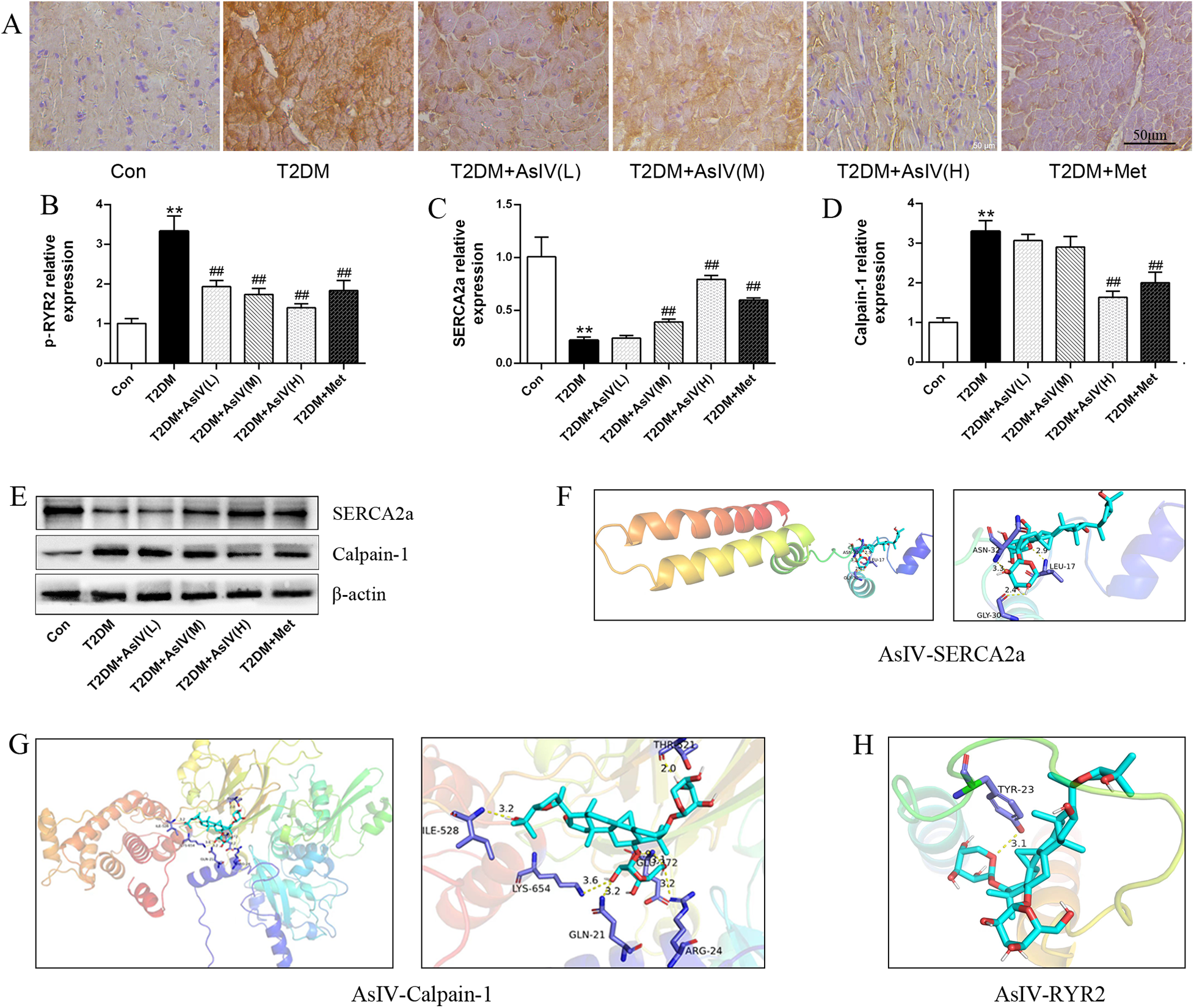 A collage of images and graphs depicting various scientific findings. Panel A shows microscopic images of tissue samples labeled Con, T2DM, T2DM+AsIV(L), T2DM+AsIV(M), T2DM+AsIV(H), and T2DM+Met. Panels B, C, and D are bar graphs displaying relative protein expression levels of p-RYR2, SERCA2a, and Calpain-1 across different conditions. Panel E shows Western blot results for SERCA2a, Calpain-1, and β-actin. Panels F and G illustrate molecular structures of AsIV-SERCA2a and AsIV-Calpain-1 interactions, while panel H shows the interaction of AsIV with RYR2, with structural representations and labeled key amino acids.