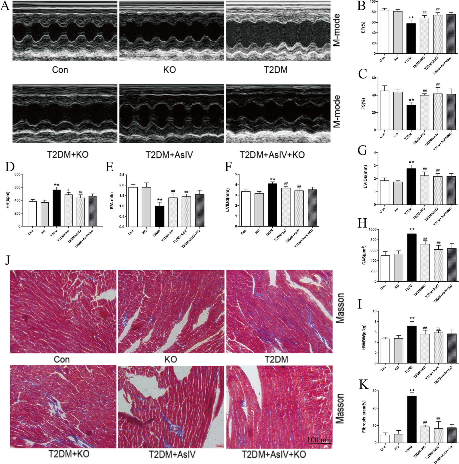 Ultrasound M-mode images and bar graphs showing cardiac parameters under various conditions: Con, KO, T2DM, T2DM+KO, T2DM+AsIV, T2DM+AsIV+KO. Parameters include EF%, FS%, HR, E/A ratio, LVID, CAs area, HW/BW ratio, and fibrosis area. Masson-stained heart tissue images are shown below, illustrating structural differences across conditions.