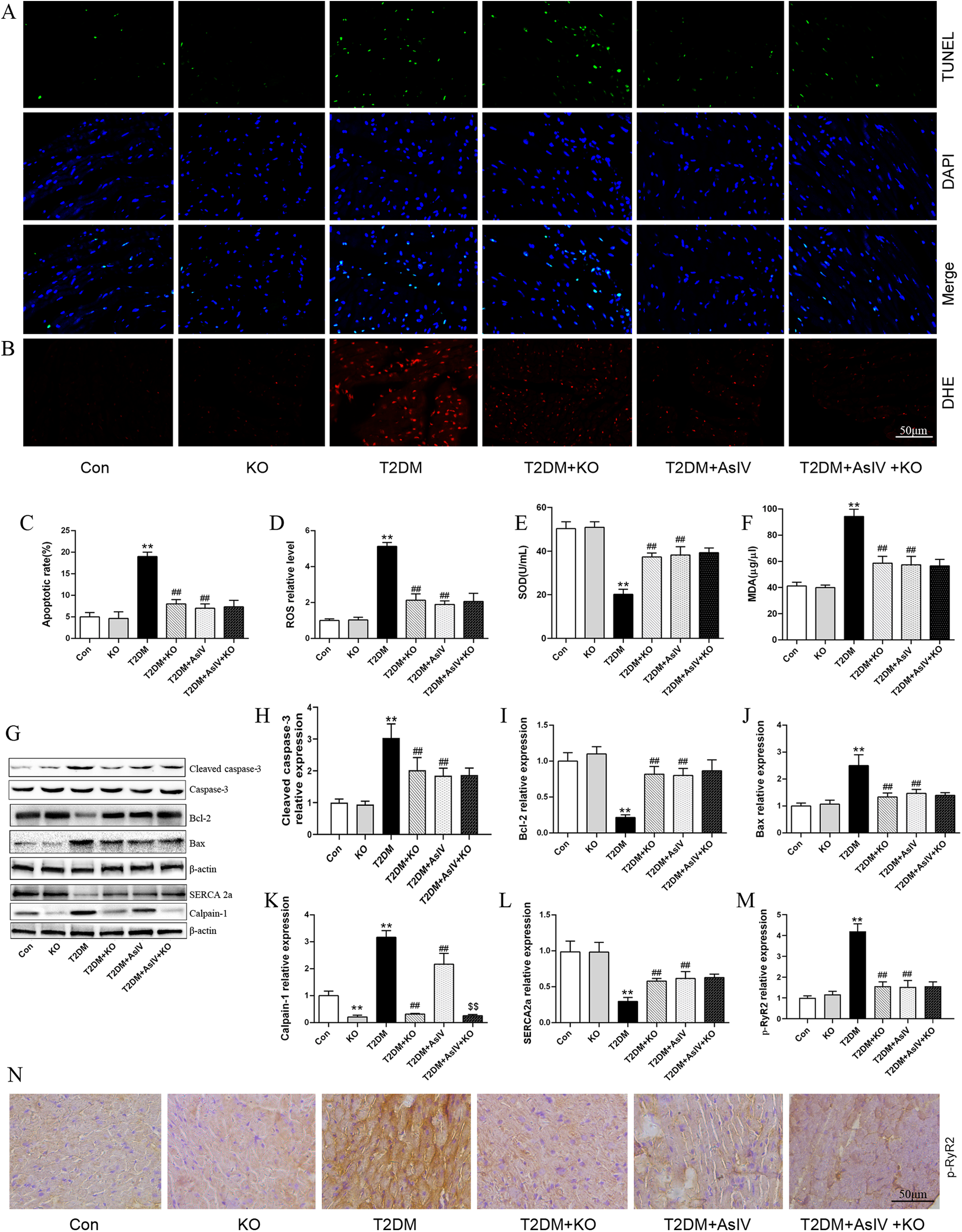 Panel A shows fluorescence microscopy images depicting TUNEL and DAPI staining, alongside merged images for control and experimental groups (KO, T2DM, T2DM+KO, T2DM+AsIV, T2DM+AsIV+KO). Panel B shows DHE staining for reactive oxygen species. Panels C to F display bar graphs illustrating apoptotic index, ROS level, SOD activity, and MDA level under similar conditions. Panel G includes Western blots for proteins like cleaved caspase-3, Bcl-2, Bax, SERCA 2a, and calpain-1, accompanied by relative expression bar graphs in panels H to M. Panel N shows additional histological staining images for each group.