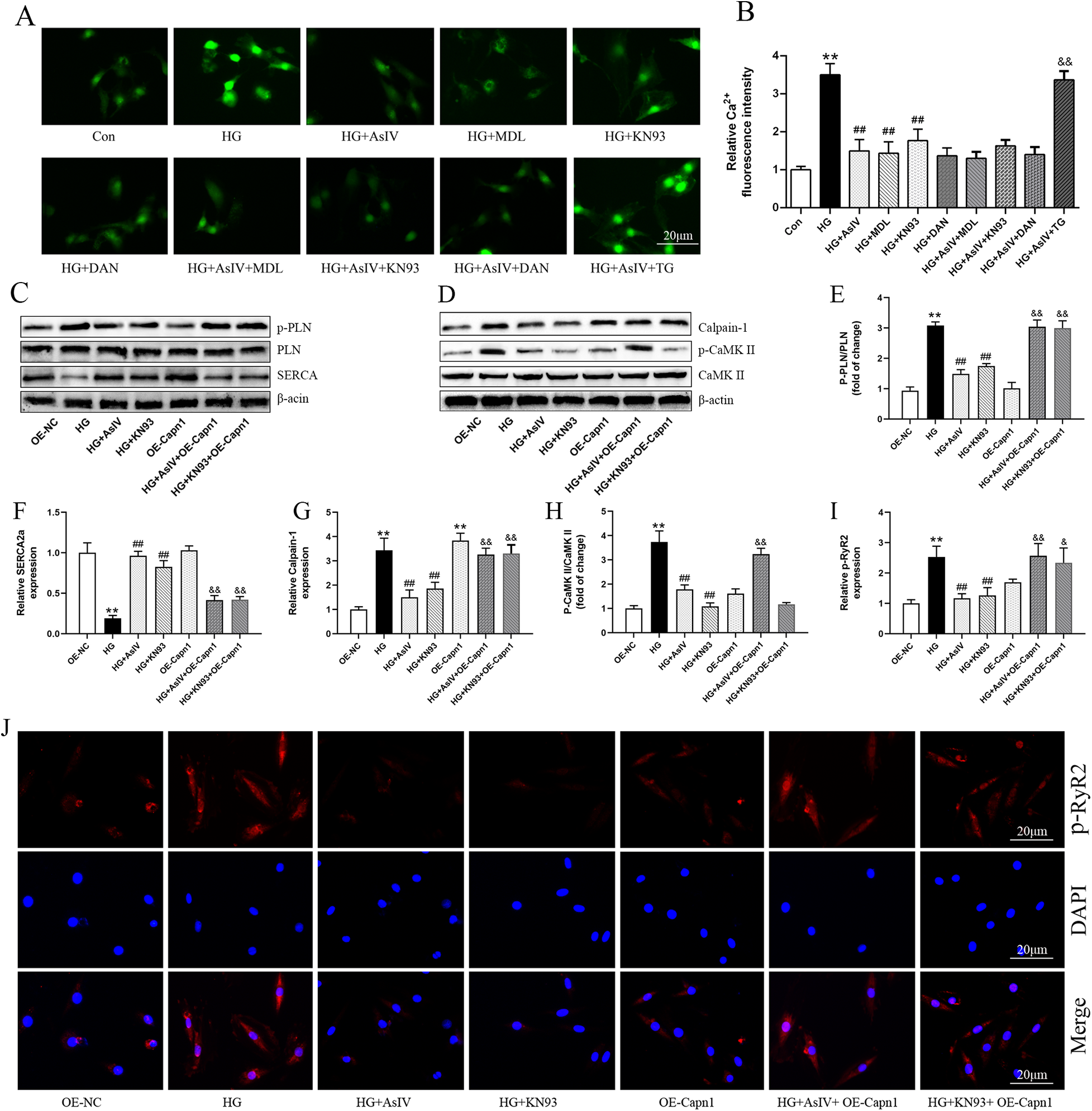 A collage of scientific images displaying cellular experiments. Panel A shows fluorescence microscopy images under different conditions. Panel B is a bar graph illustrating relative calcium fluorescence intensity across conditions. Panels C and D present Western blots of specific proteins, with corresponding quantitative bar graphs (E-I) showing relative expression levels. Panel J features fluorescent microscopy images highlighting P-RYR2 and DAPI staining across different experimental treatments. Scale bars indicate 20 micrometers.