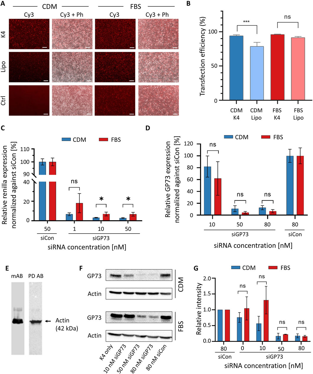 Composite image depicting experimental data on siRNA transfection efficiency and gene expression. Panel A shows fluorescent microscopy images comparing transfection efficiency of K4, Lipofetamine, and control for cells cultured in CDM and FBS. Panel B presents a bar graph of transfection efficiency, highlighting significant differences. Panels C displays a bar graph of a dual luciferase assay measuring silencing of GP73 relative to control, with statistical significance indicated. Panel D presents a bar graph of silencing efficiency of the endogenously expressed GP73 measured by qRT-PCR, with statistical significance indicated. Panel E is an immunoblot of actin to demonstrate suitability of the phage display-derived antibody. Panel F shows immunoblot results for GP73 silencing and actin under different conditions. Panel G is a bar graph of relative intensity measurements. Statistical significance is marked by asterisks.
