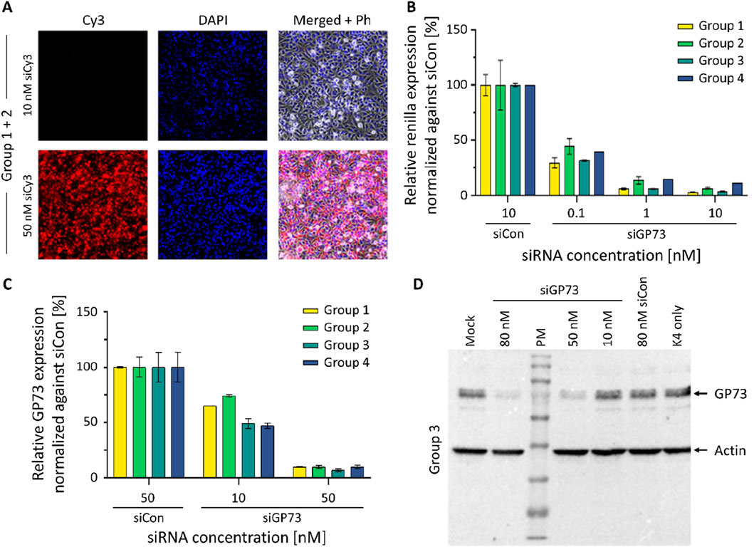 Results of a student laboratory course. Panel A shows fluorescence microscopy images with Cy3 and DAPI for two siRNA concentrations, with merged images illustrating cell morphology. Panel B is a bar graph displaying relative renilla expression normalized against siCon for different siRNA concentrations across four groups. Panel C features a bar graph of relative GP73 expression normalized against siCon for various siRNA concentrations across four groups. Panel D presents a western blot showing GP73 and Actin levels with different siRNA treatments, highlighting Group 3 data.