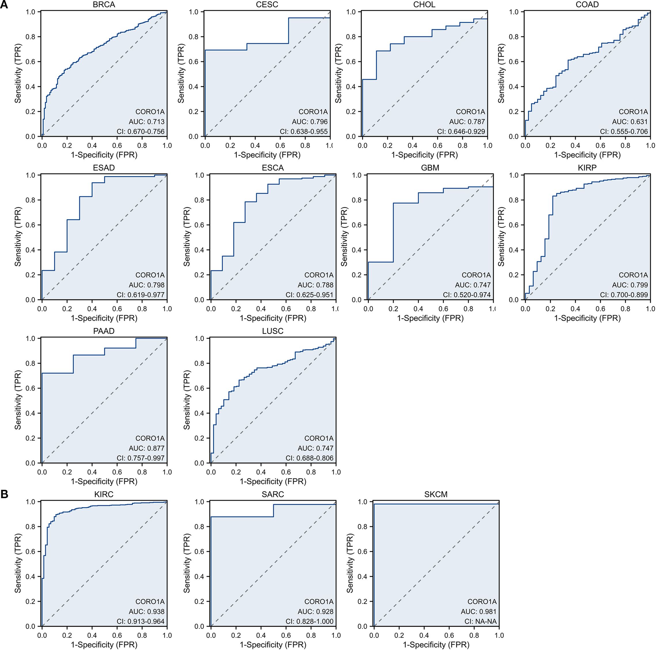 Nine graphs display Receiver Operating Characteristic (ROC) curves for different cancer types: BRCA, CESC, CHOL, COAD, ESAD, ESCA, GBM, KIRP, PAAD, LUSC, KIRC, SARC, and SKCM. Each graph shows sensitivity versus one minus specificity, with dashed diagonal lines indicating random classification. The area under the curve (AUC) values and confidence intervals (CI) are noted for each, demonstrating varying predictive performances of CORO1A.
