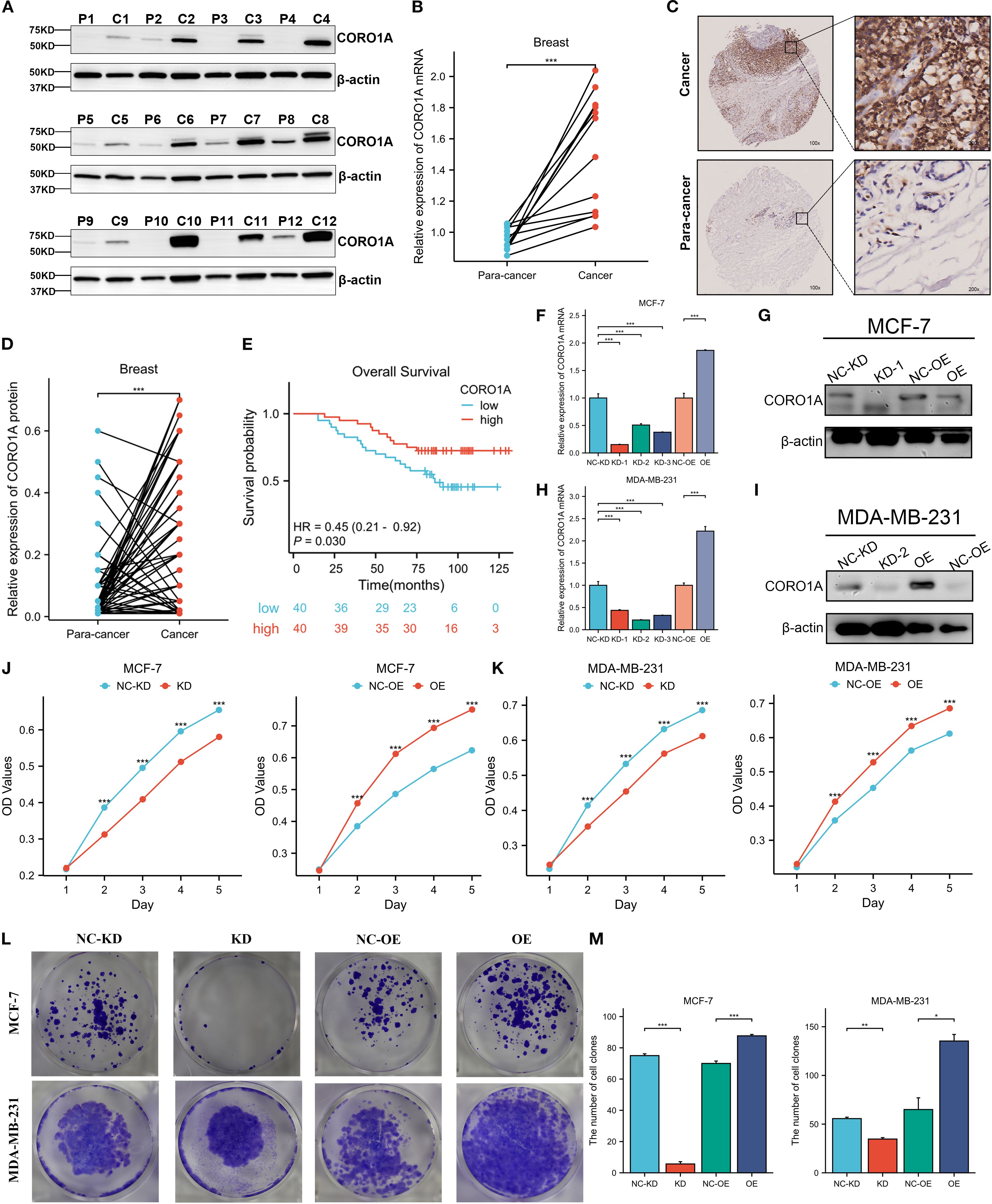 Composite image illustrating various scientific data related to the CORO1A protein in cancer studies. Panels A, G, and I display Western blot analyses indicating CORO1A and β-actin levels in different samples. Panel B shows a graph comparing CORO1A mRNA expression in para-cancer and cancerous breast tissues. Panel C presents immunohistochemistry images of cancer and para-cancer tissues, highlighting CORO1A presence. Panel D illustrates a comparative graph of CORO1A protein expression. Panel E features a survival probability chart based on CORO1A levels. Panels F, H, J, K, L, and M present various graphs and images depicting experimental results and quantitative analyses of cell growth and colony formation in different cell lines.