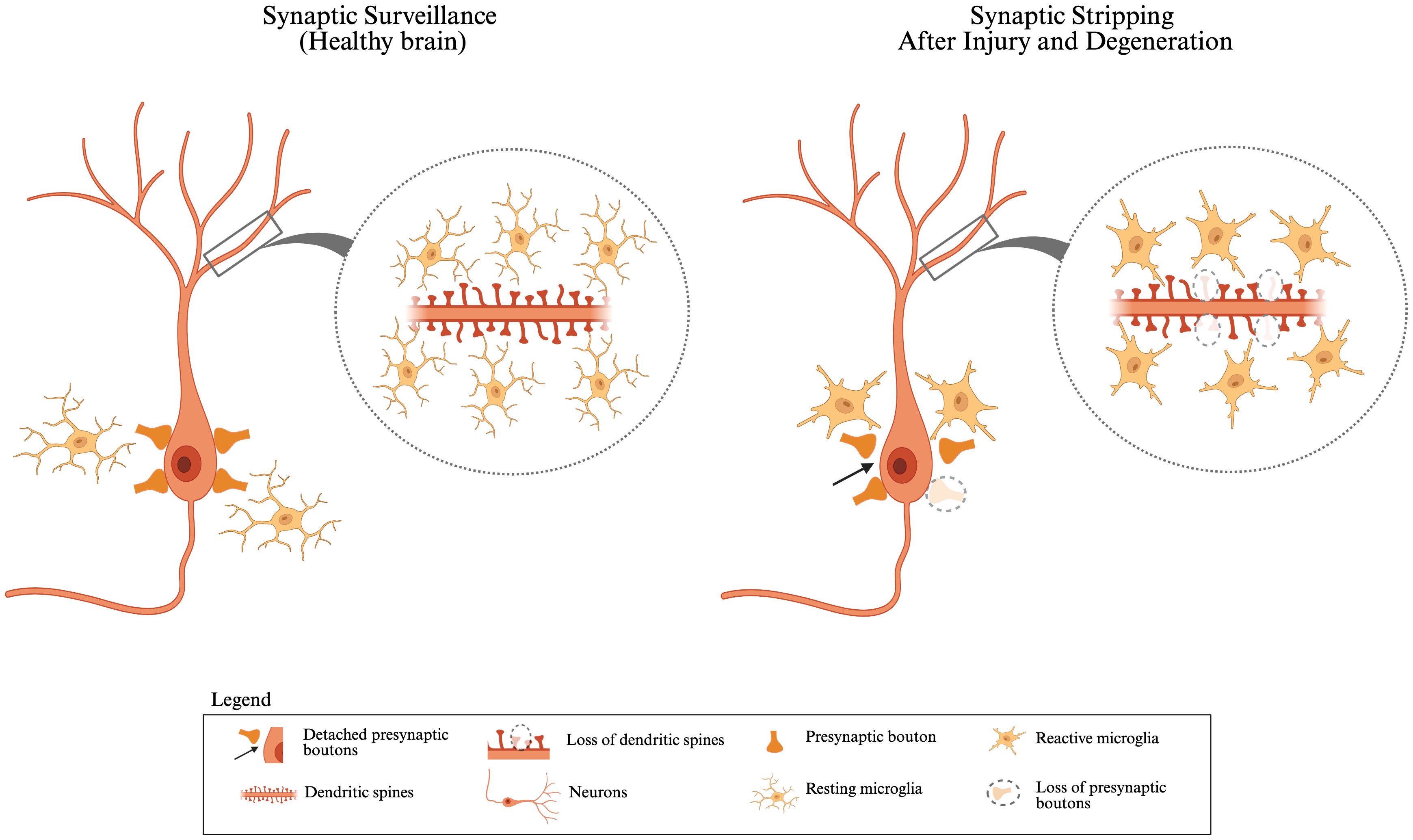 Diagram contrasting synaptic surveillance in a healthy brain and synaptic stripping after injury. The left side shows a neuron with intact presynaptic boutons and dendritic spines surrounded by resting microglia. The right side illustrates neuron symbiosis disruption, showing detached presynaptic boutons, loss of dendritic spines, and reactive microglia. A legend explains symbols: detached presynaptic boutons, neuron components, resting and reactive microglia, and synaptic receptor loss.