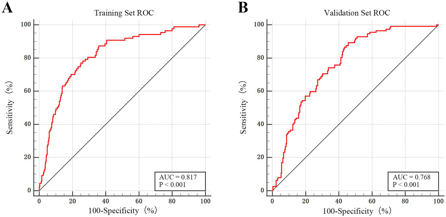 Side-by-side ROC curve graphs. Graph A shows the Training Set ROC with a red curve and an AUC of 0.817, indicating high accuracy. Graph B displays the Validation Set ROC with a red curve and an AUC of 0.768, showing lower accuracy. Both graphs plot sensitivity versus 100-specificity.