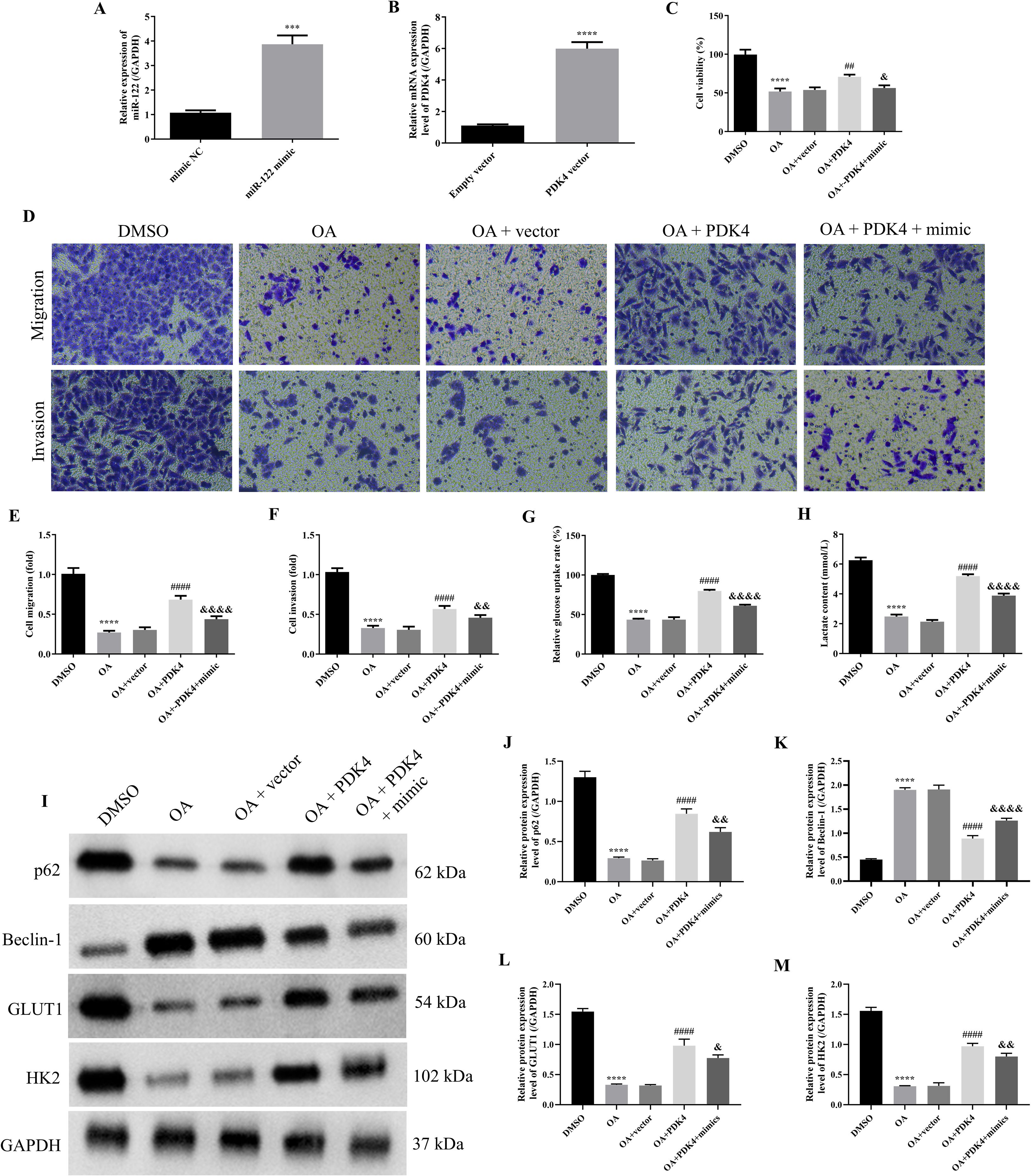 Bar graphs and microscopic images display experimental results on mRNA expression, cell density, migration, and invasion under different treatments: DMSO, OA, OA with vector, OA with PDK4, and OA with PDK4 mimic. Western blots show protein levels of p62, Beclin-1, GLUT1, HK2, and GAPDH. Data indicate significant differences between conditions, highlighting molecular and cellular changes.