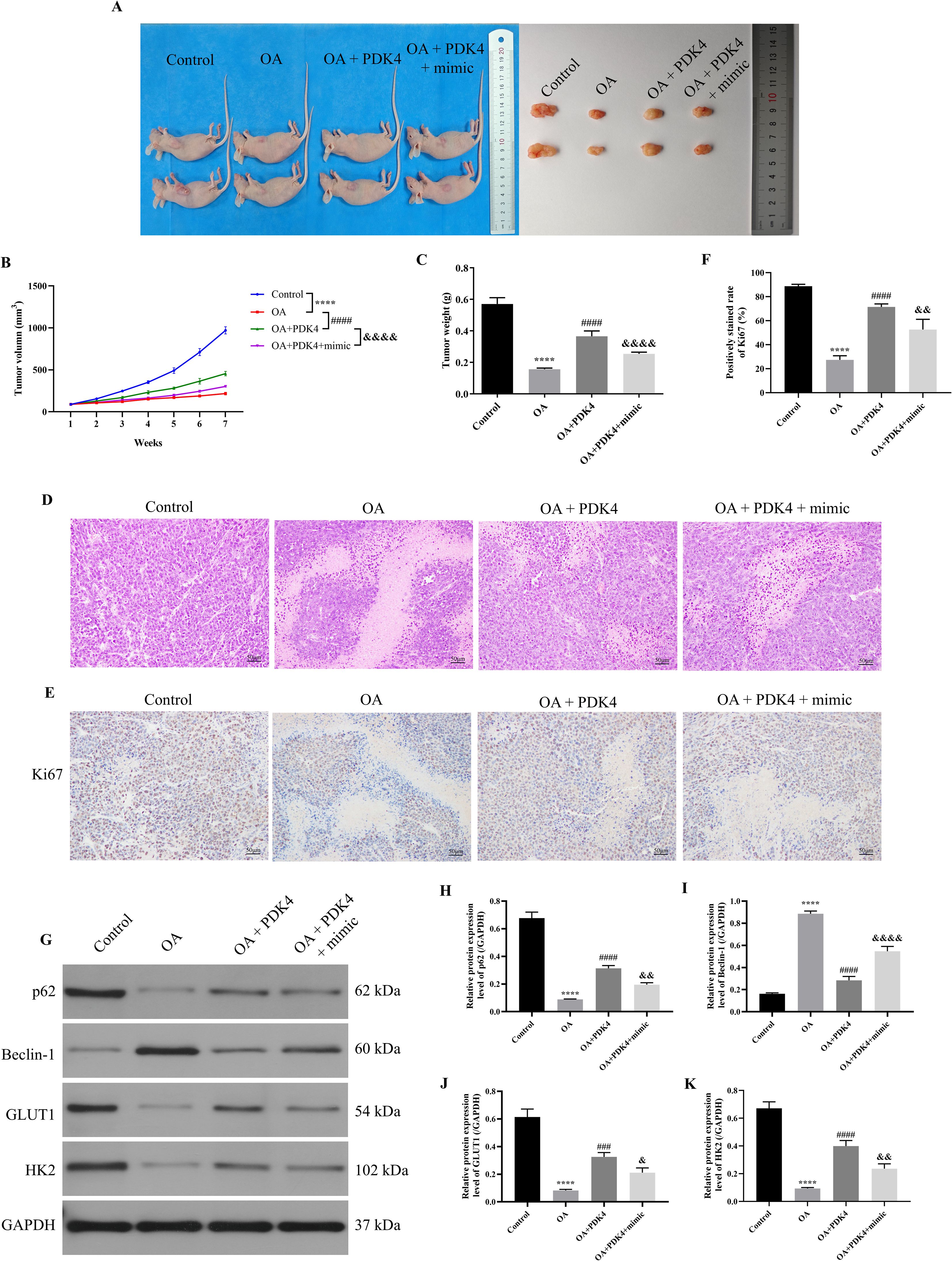 A composite image displays multiple panels related to a scientific study involving mice and tumor growth. Panel A shows mice divided into four groups: Control, OA, OA + PDK4, and OA + PDK4 + mimic, with excised tumors shown beside a ruler. Panel B presents a line graph of tumor volumes over seven weeks for each group. Panel C is a bar graph showing tumor weights for each group. Panel D features histological images of tissue samples stained to reveal cell morphology, with variations across the groups. Panel E shows Ki67 staining indicating cell proliferation in tissues. Panel G displays a Western blot for proteins p62, Beclin-1, GLUT1, HK2, and GAPDH with corresponding bar graphs H-K illustrating relative protein expression levels. Each grouping shows differential effects of treatments on tumor characteristics and protein expressions.