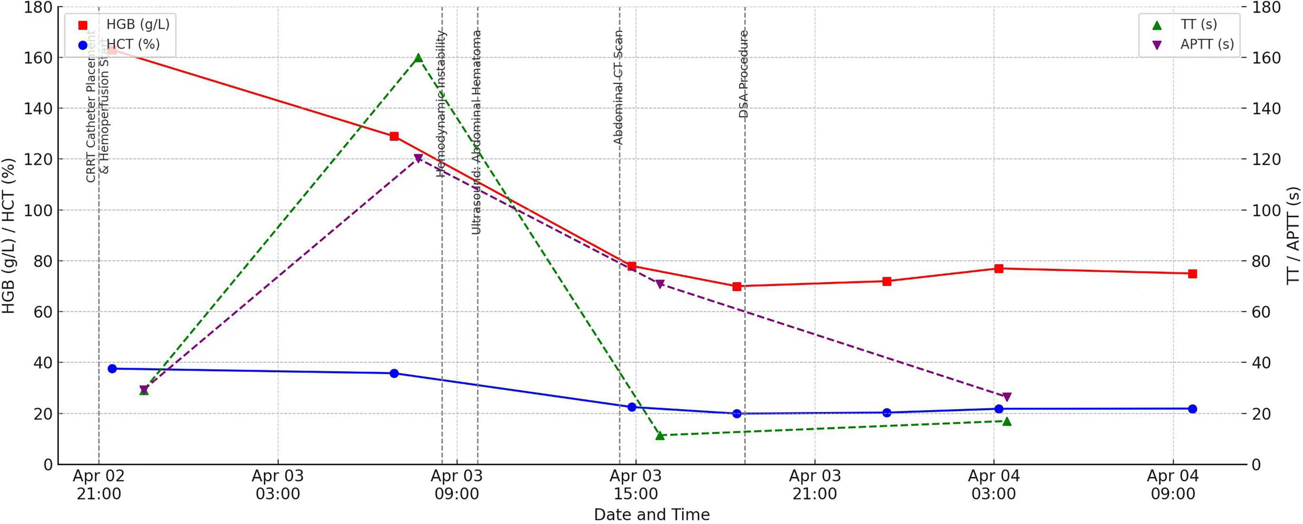 “Line graph showing trends in hemoglobin (HGB), hematocrit (HCT), thrombin time (TT), and activated partial thromboplastin time (APTT) from April 2 to April 4: HGB and HCT showed a continuous decline during April 2–4 before stabilizing following digital subtraction angiography (DSA) therapy; TT peaked on April 3 before decreasing, with APTT exhibiting a similar trend. Events such as CT scans and surgeries are marked on April 3.”