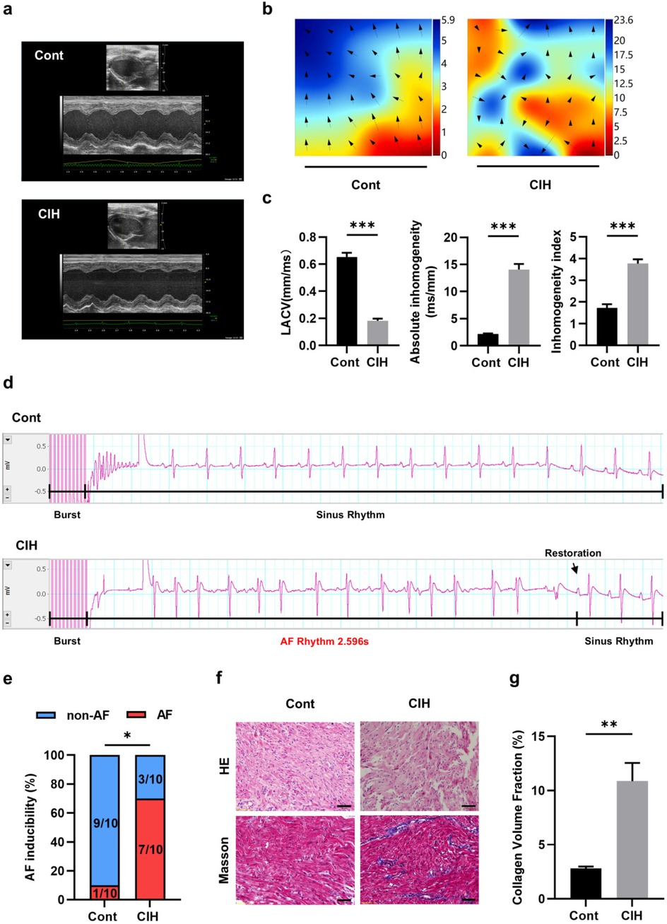 Multifigure scientific image illustrating cardiac analysis under different conditions. Panel (a) shows ultrasound images comparing control (Cont) and chronic intermittent hypoxia (CIH) conditions. Panel (b) presents vector field diagrams. Panel (c) contains bar graphs comparing left atrial conduction velocity (LACV), absolute inhomogeneity, and inhomogeneity index, showing significant differences. Panel (d) displays electrocardiogram (ECG) traces depicting rhythmic changes between Cont and CIH. Panel (e) features a bar graph of atrial fibrillation (AF) inducibility percentages, indicating increased AF in CIH. Panel (f) presents histological images with HE and Masson staining. Panel (g) shows a bar graph of collagen volume fraction, with a significant increase in CIH.