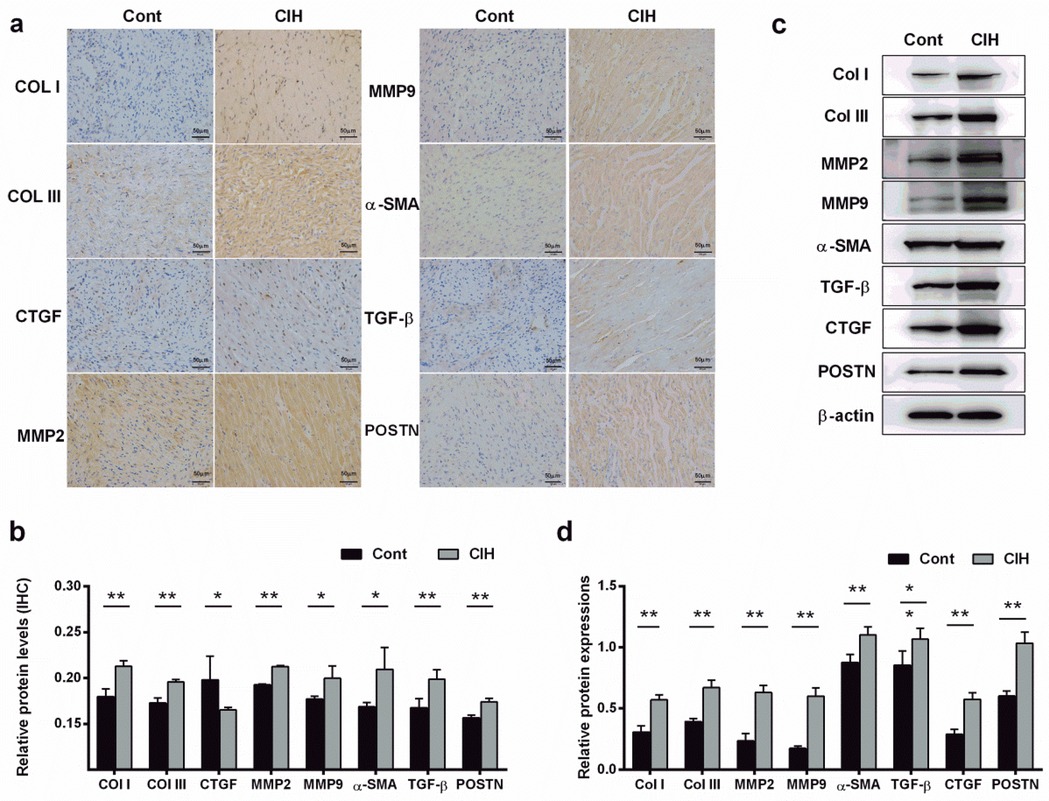 Panel (a) shows histological images comparing tissue samples labeled with various protein markers between control (Cont) and chronic intermittent hypoxia (CIH) groups. Proteins include Col I, Col III, CTGF, MMP2, MMP9, α-SMA, TGF-β, and POSTN. Panel (b) displays a bar graph showing relative protein levels for these markers, indicating differences between Cont and CIH groups, with significance marked by asterisks. Panel (c) features Western blot results for the same proteins, showing expression variations between Cont and CIH. Panel (d) contains another bar graph depicting relative protein expressions, with significant differences denoted by asterisks.