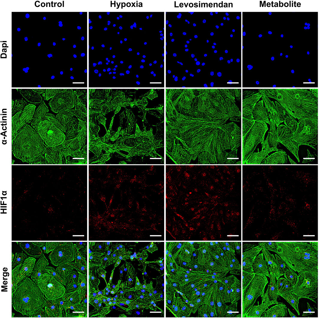 Fluorescence microscopy images showing four conditions: Control, Hypoxia, Levosimendan, and Metabolite, across four rows. The first row, labeled