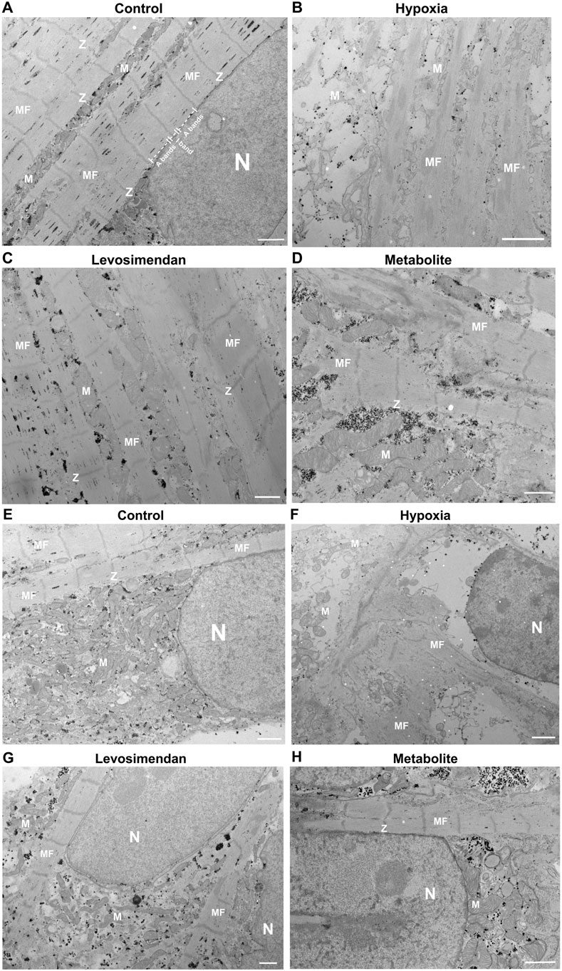 Electron micrographs display myocardial tissue under different conditions: Control (A, E), Hypoxia (B, F), Levosimendan (C, G), and Metabolite (D, H). Key structures labeled include nucleus (N), mitochondria (M), myofibrils (MF), and Z bands (Z). Each image reveals variations in tissue structure and morphology corresponding to the experimental conditions.