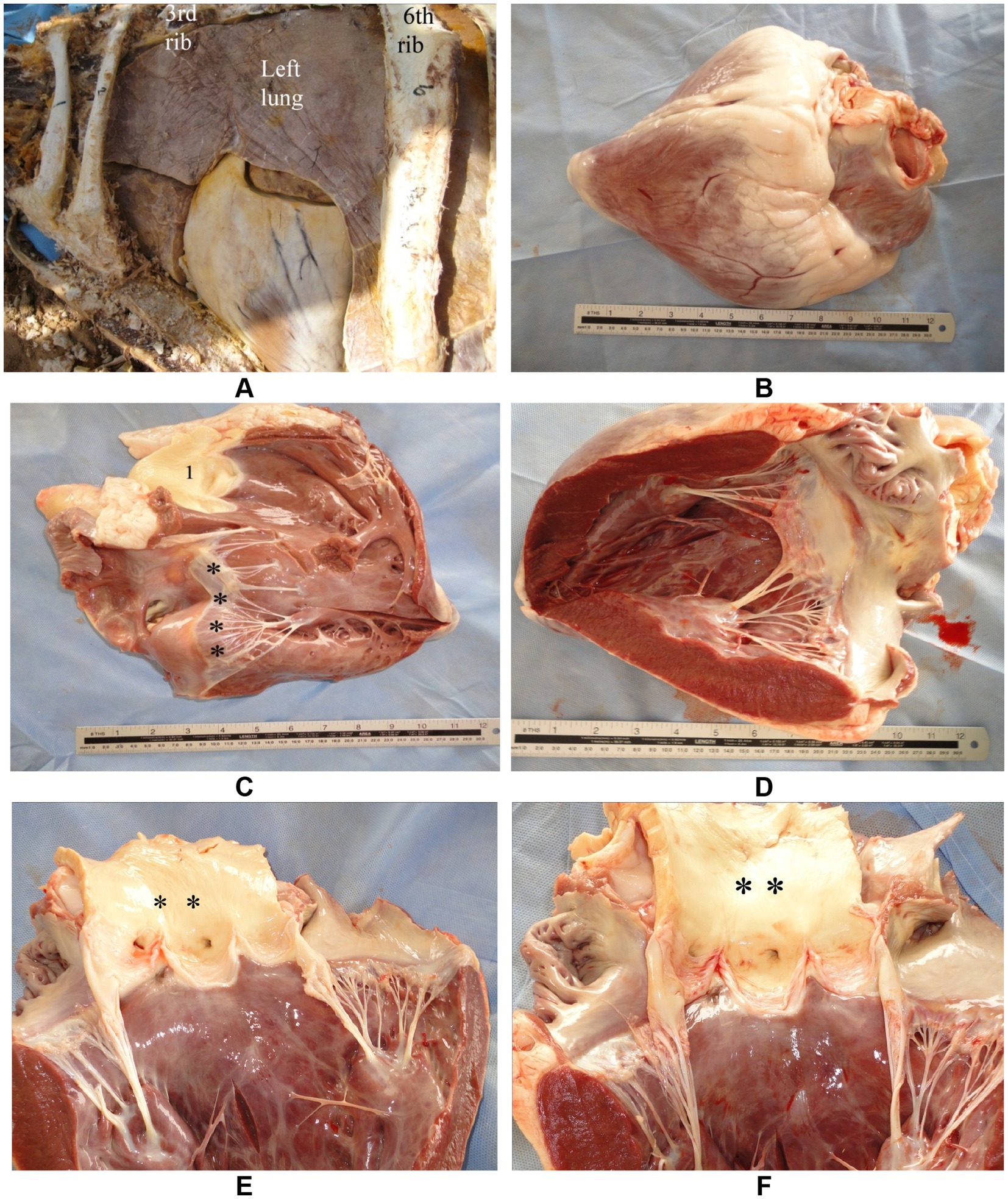 Image showing six labeled panels of anatomical specimens. Panel A displays a thoracic cavity with visible ribs and a lung. Panel B shows an exterior view of a heart. Panels C and D reveal bisected views of the heart’s interior musculature and chambers, marked with asterisks and ruler for scale. Panels E and F provide close-up views of the heart valves and internal structures, again with asterisks indicating specific areas. The background of each panel is a blue surgical drape.
