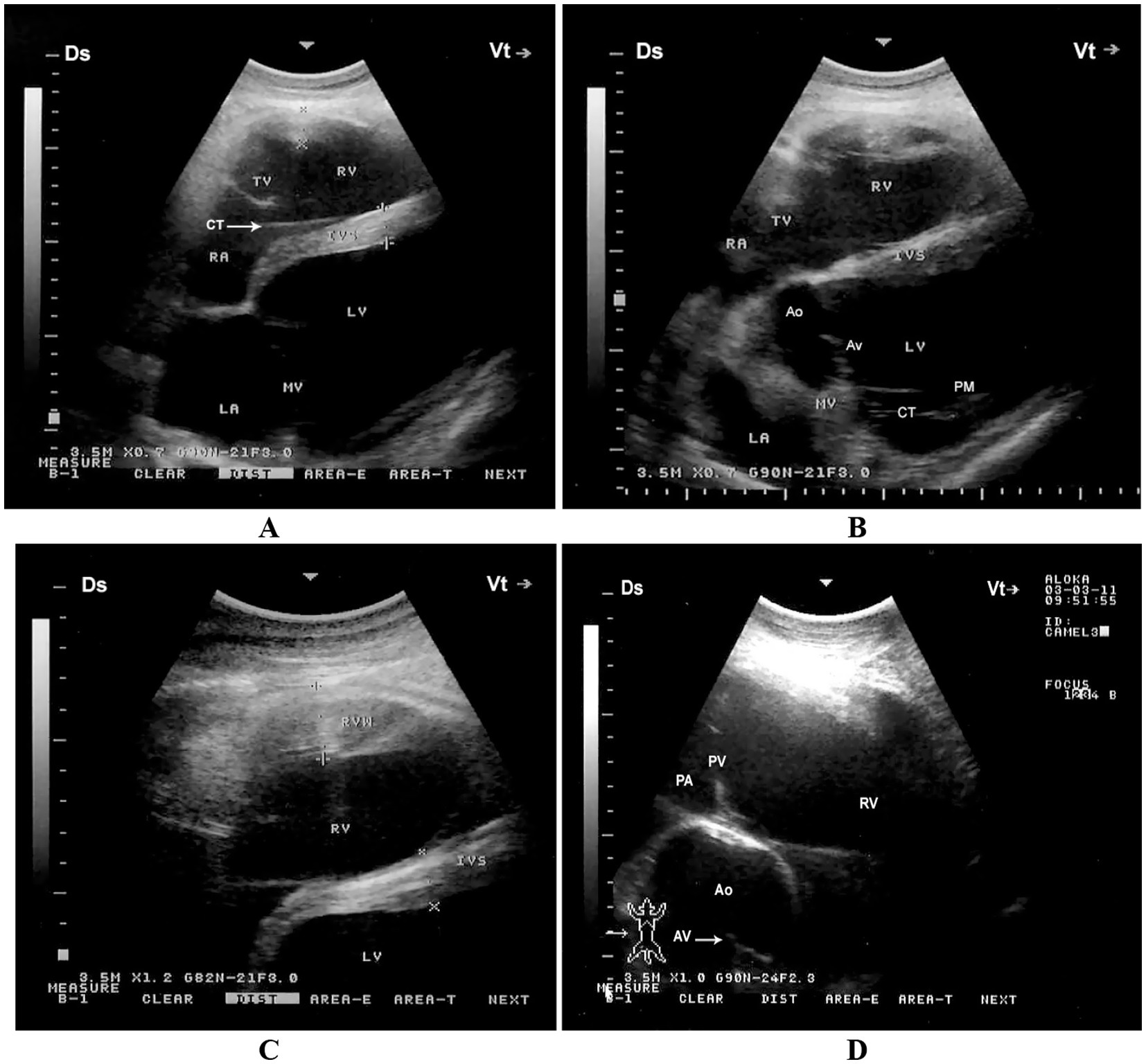 Ultrasound images labeled A to D, displaying different views of the heart. Image A shows the right atrium (RA), left atrium (LA), and the tricuspid valve (TV). Image B highlights the right ventricle (RV), aortic valve (Av), and mitral valve (MV). Image C focuses on the right ventricle (RV) and interventricular septum (IVS). Image D features the pulmonary artery (PA), pulmonary valve (PV), and aorta (Ao).