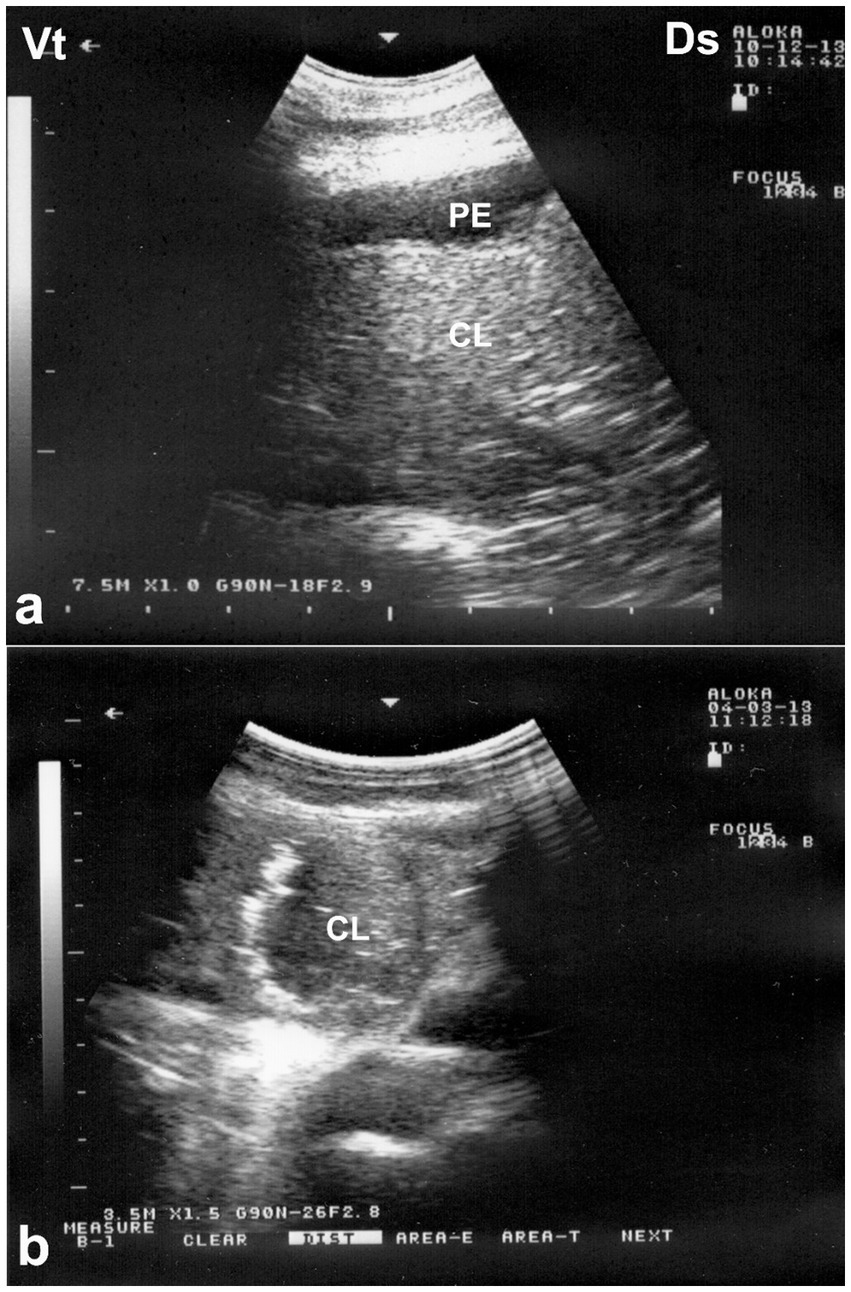 Ultrasound images showing two views: Image