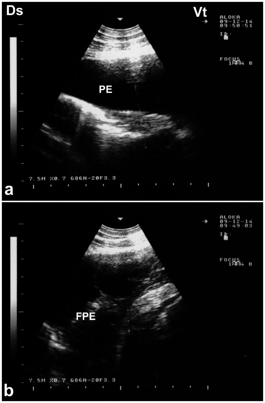 Ultrasound images labeled (a) and (b). Image (a) shows