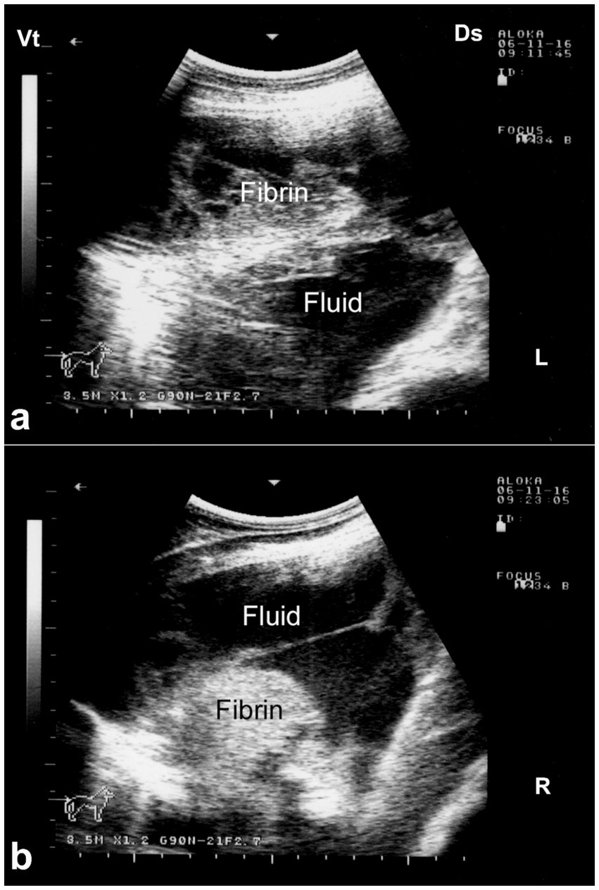 Two ultrasound images labeled