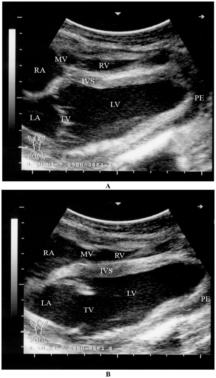 Ultrasound images showing cross-sectional views of the heart. Both images include labeled anatomical structures: RA (right atrium), LA (left atrium), RV (right ventricle), LV (left ventricle), MV (mitral valve), TV (tricuspid valve), IVS (interventricular septum), and PE (pericardium). Panel A and B are nearly identical, highlighting cardiac anatomy.