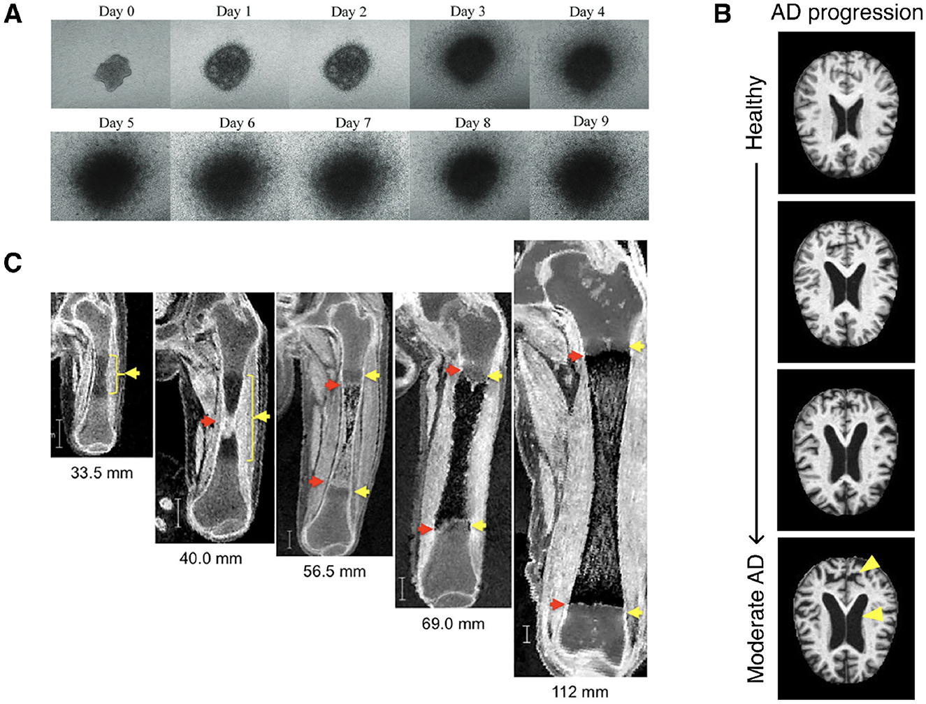 Panel A shows a series of images from Day 0 to Day 9 illustrating the growth of a cellular or microscopic structure. Panel B displays MRI brain scans depicting AD progression from healthy to moderate stages. Panel C consists of scans of a bone or similar structure over various lengths, highlighting changes as indicated by red and yellow arrows and length measurements of 33.5 mm to 112 mm.