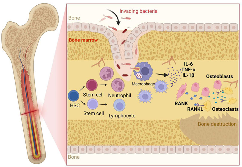Cross-section diagram of a bone showing bacterial invasion into the bone marrow. Illustrates interaction of hematopoietic stem cells, neutrophils, and macrophages, with cytokines IL-6, TNF-alpha, IL-1beta activating osteoclasts via RANK and RANKL, leading to bone destruction.
