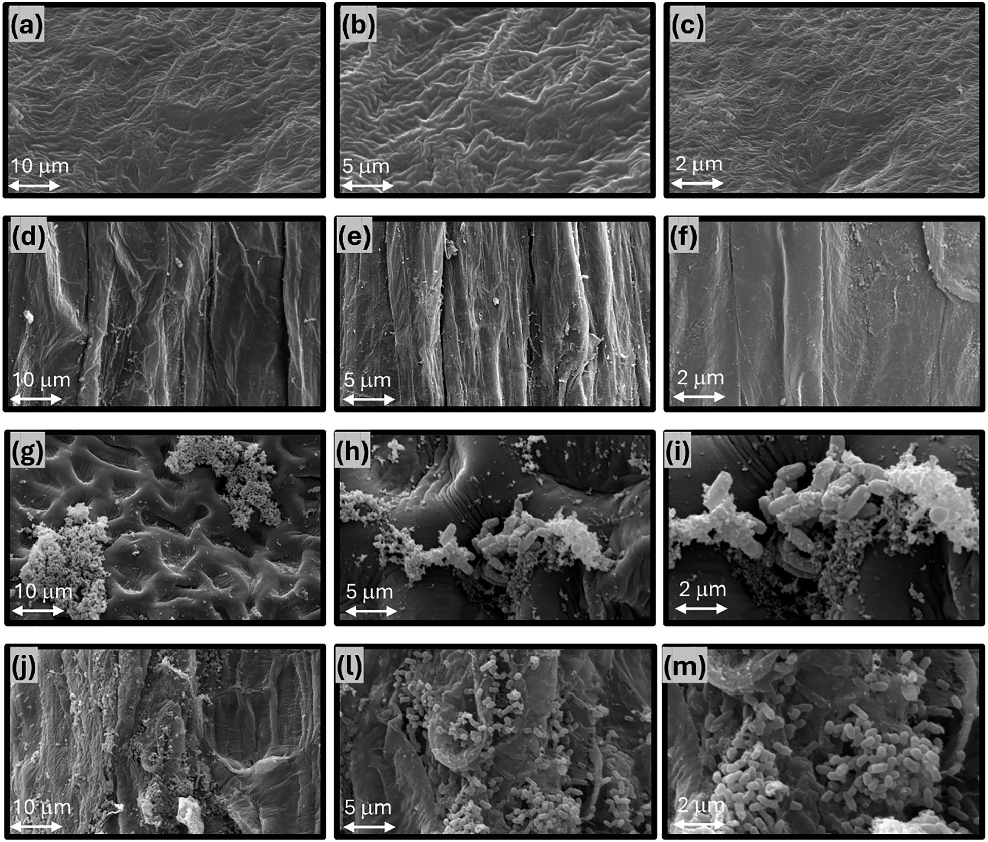 Scanning electron microscope images of material surfaces at different magnifications. Panels (a), (b), and (c) show smooth, wavy textures at 10, 5, and 2 micrometers. Panels (d), (e), and (f) depict vertical striations. Panels (g), (h), and (i) reveal rough surfaces with granular clusters. Panels (j), (k), and (m) illustrate textured surfaces with varying particle deposits. Each panel shows scale bars indicating magnification levels.