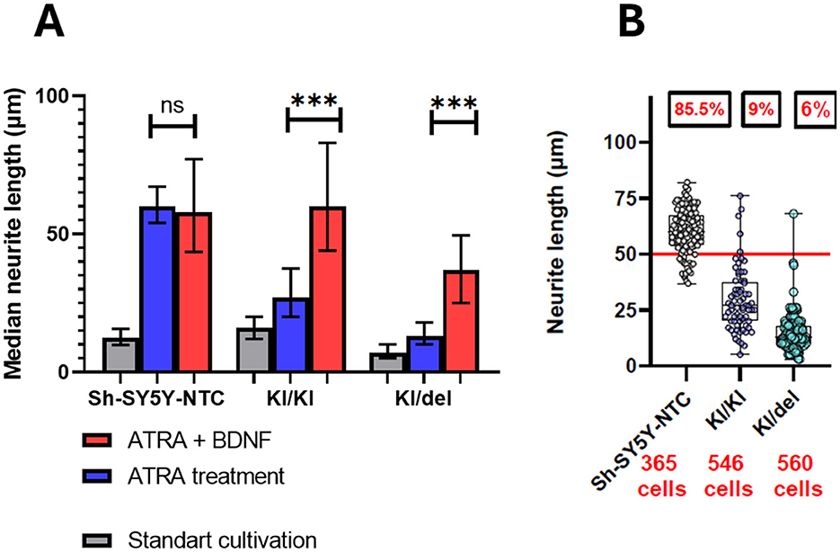 Bar and scatter plot showing neurite lengths. Panel A: Bar plot comparing median neurite lengths of Sh-SY5Y-NTC, KI/KI, and KI/del groups under different treatments: ATRA plus BDNF (red), ATRA (blue), and standard cultivation (gray). Significant differences are marked with asterisks. Panel B: Scatter plot displaying neurite lengths for the same groups, with percentages and cell counts labeled (Sh-SY5Y-NTC: 85.5% and 365 cells, KI/KI: 9% and 546 cells, KI/del: 6% and 560 cells).