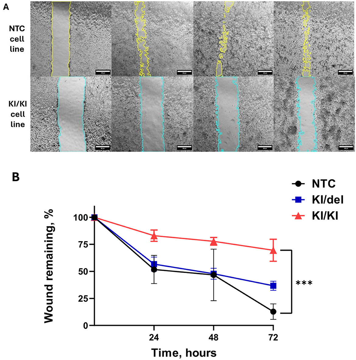 Panel A shows microscopic images of cell lines NTC and KI/KI with cell migration over time marked by colored lines. Panel B is a line graph displaying wound closure over 72 hours for NTC, KI/del, and KI/KI cell lines, with NTC showing the most reduction and KI/KI the least. Statistical significance is indicated with three stars.