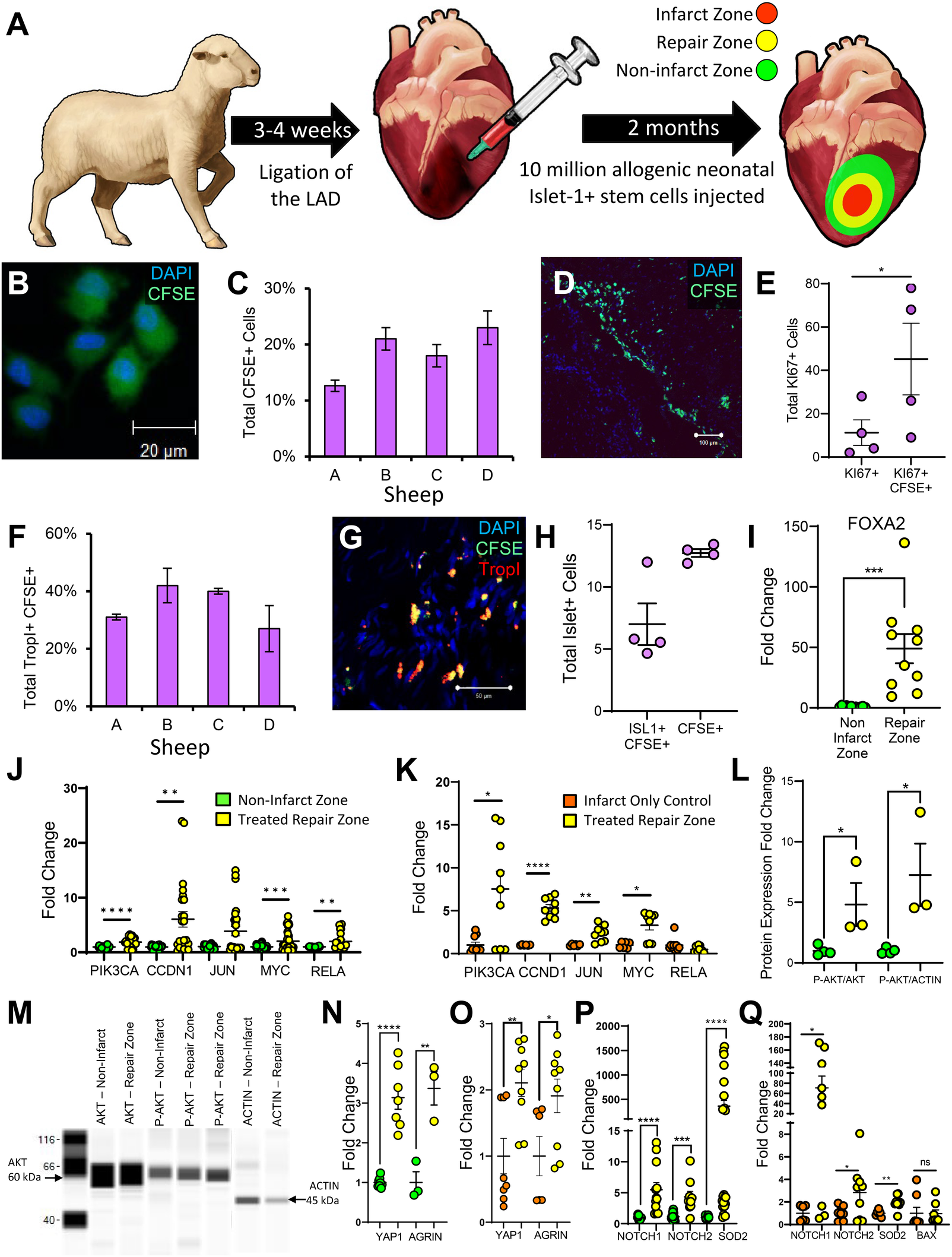 Diagram illustrating a study on sheep involving cardiac procedures. It includes a timeline of ligation of the LAD and stem cell injections, graphs of various cellular analyses, and a Western blot analysis. Details show changes in cell markers, protein expression across different heart zones, and statistical significance is indicated by asterisks.