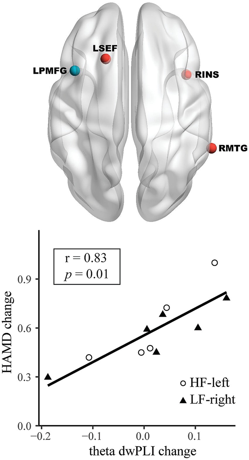 Illustration of a brain with key areas marked: LPMFG, LSEF, RINS, and RMTG. Below, a scatter plot shows a positive correlation between theta dwPLI change and HAMD change, with an r-value of 0.83 and p-value of 0.01. Different markers represent data from HF-left and LF-right groups.