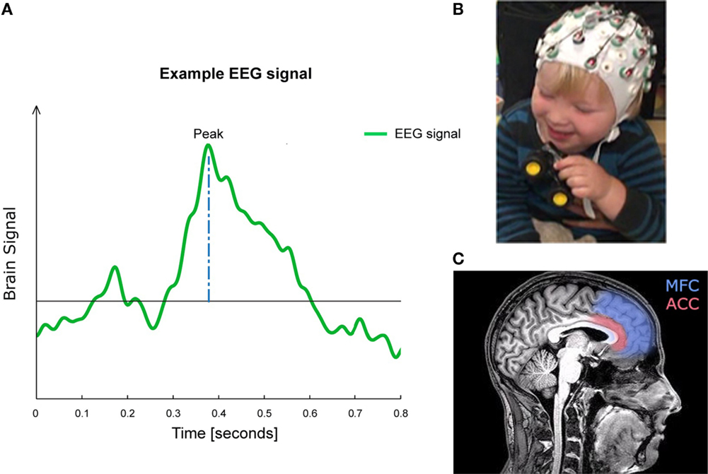 איור 1 - דוגמה לאות EEG (A) כך יכול להיראות אות מוח הנמדד ב-EEG.
