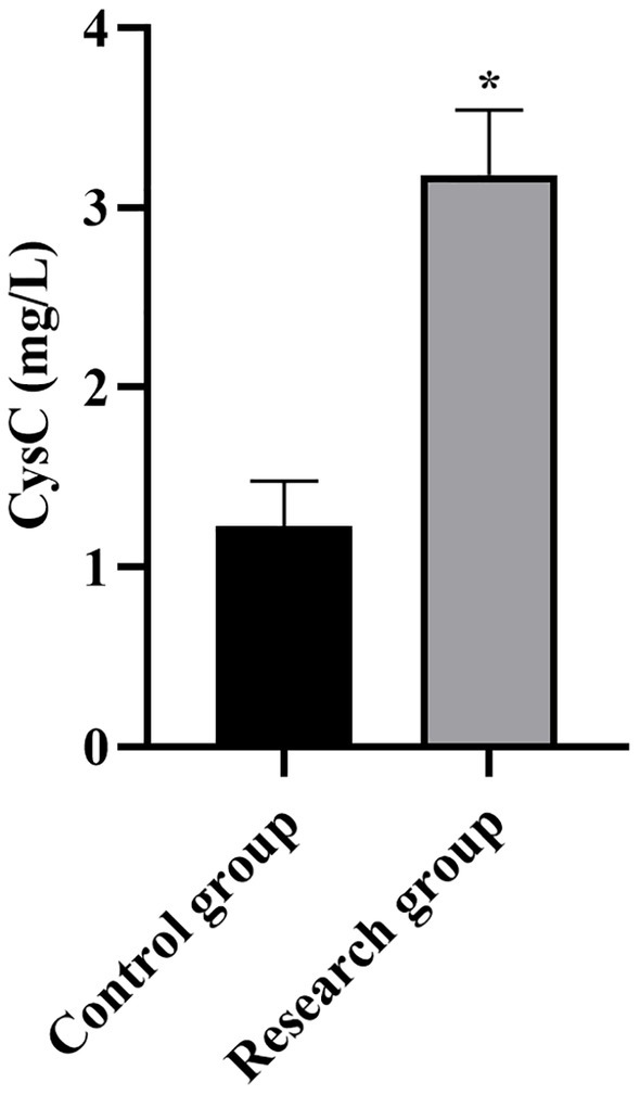 Bar graph comparing Cystatin C levels in control and research groups. The research group shows a higher Cystatin C level, approximately 3.5 milligrams per liter, with a significant difference marked by an asterisk.