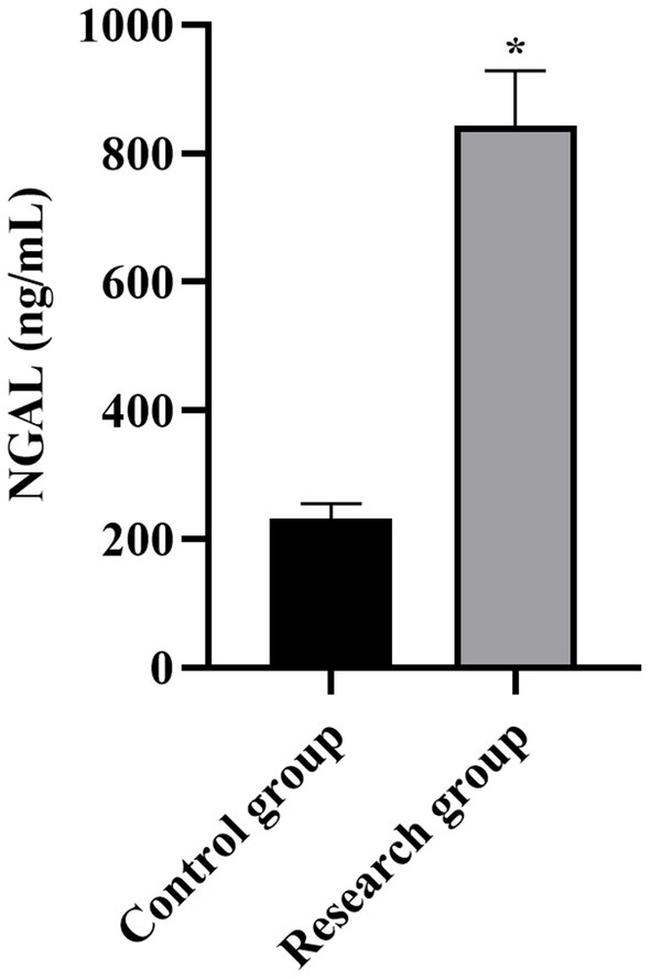 Bar graph showing NGAL levels in nanograms per milliliter. The control group has approximately 200 ng/mL, while the research group shows about 900 ng/mL, with a significant increase indicated by an asterisk.