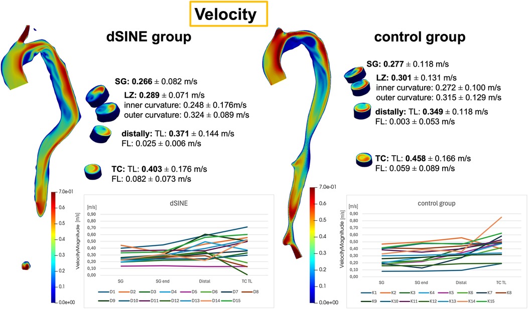 Velocity distributions comparing dSINE and control groups, presented as color-coded 3D aortic models and corresponding line graphs. Mean velocity values with standard errors are shown at the stent graft (SG), landing zone (LZ), distal aorta, and true lumen at the coeliac trunk (TC). Individual patient trajectories are represented as separate lines within each group.