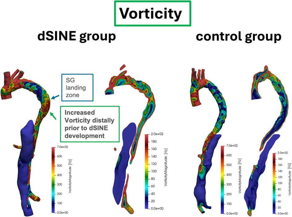 Color-coded diagrams compare aortic vorticity patterns between the dSINE group (left) and the control group (right). In the dSINE group, increased vorticity distal to the stent graft is evident even before dSINE development, highlighted by red and orange hues, indicating a more disturbed flow environment. In contrast, the control group shows lower vorticity with cooler blue tones, reflecting a stable flow profile. Scale bars indicate vorticity magnitude, ranging from 0-700 Hz for the dSINE group and 0-200 Hz for the control group.