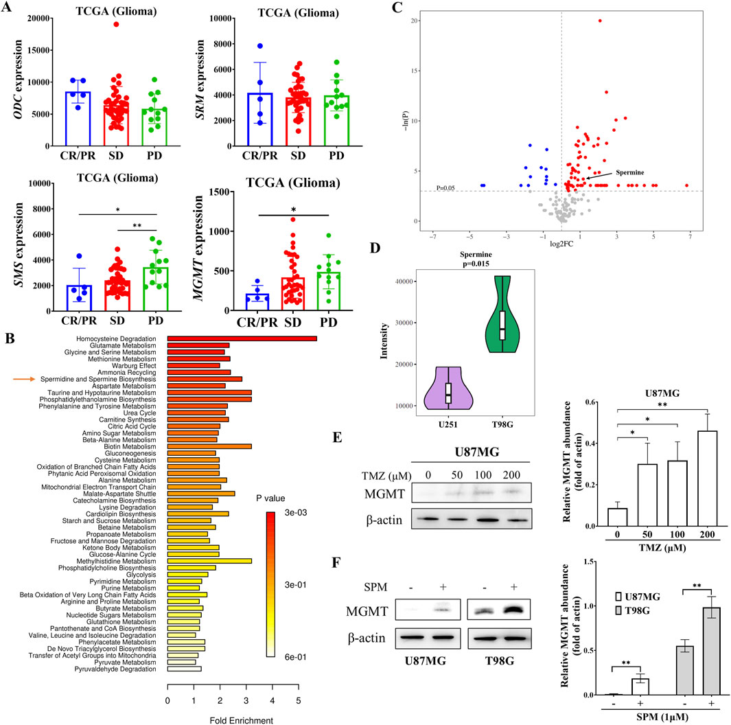 Panel A shows bar graphs of ODC, SRM, SMS, and MGMT expression in glioma tissues. Panel B is a bar chart of metabolic pathway enrichment. Panel C is a volcano plot with spermine indicated. Panel D displays a violin plot of spermine intensity in U251 and T98G cell lines. Panels E and F present Western blots and bar graphs of MGMT abundance in U87MG and T98G cell lines with varying treatments of TMZ and spermine. Statistical significance is marked with asterisks.
