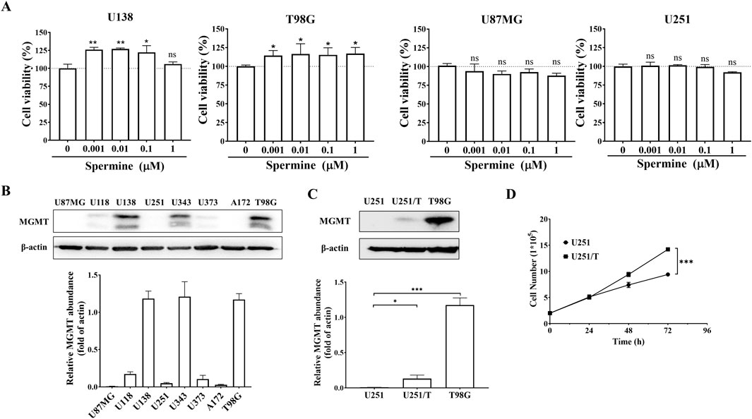 Panel A shows bar graphs of cell viability at various spermine concentrations in four cell lines with statistical significance marked. Panel B displays an MGMT and β-actin protein expression Western blot across several cell lines, with relative MGMT abundance shown below. Panel C presents a Western blot and relative abundance for MGMT expression in U251, U251/T, and T98G cell lines with significance indicators. Panel D illustrates a line graph comparing cell numbers over time for U251 and U251/T lines, indicating significant difference at seventy-two hours.