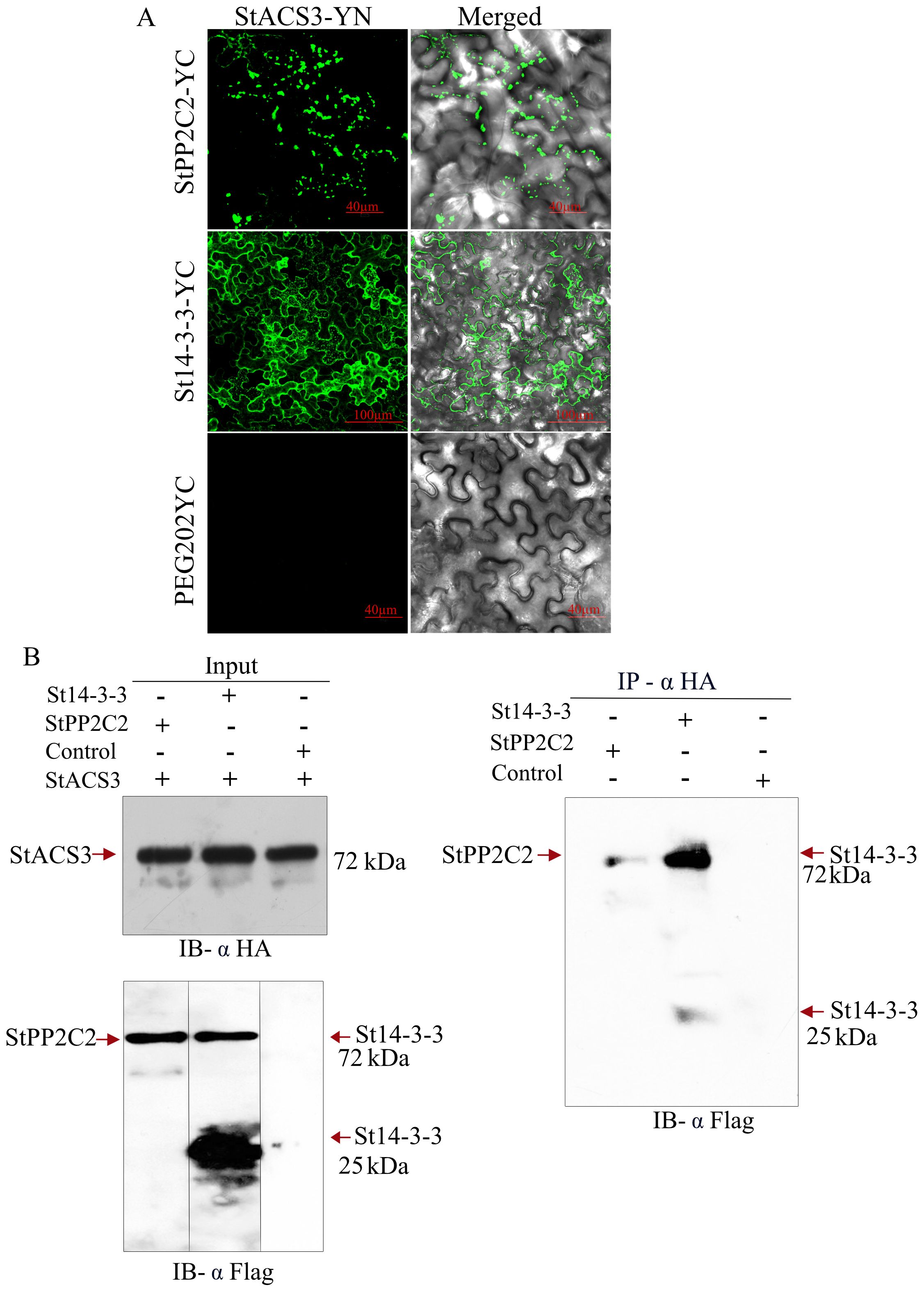 Analysis of StACS3 protein interactions. (A) Fluorescence microscopy images showing protein-protein interaction between StACS3-YN and its partners (StPP2C2-YC, St14-3-3-YC) using a bimolecular fluorescence complementation assay. The merged images with visible green fluorescence indicate successful interaction. (B) Co-IP and immunoblot results confirming the binding of StACS3 to StPP2C2 and St14-3-3 proteins. The right panel shows the co-immunoprecipitated proteins at 72 kDa and 25 kDa, demonstrating the specific interactions, while the left panels show the input protein controls.