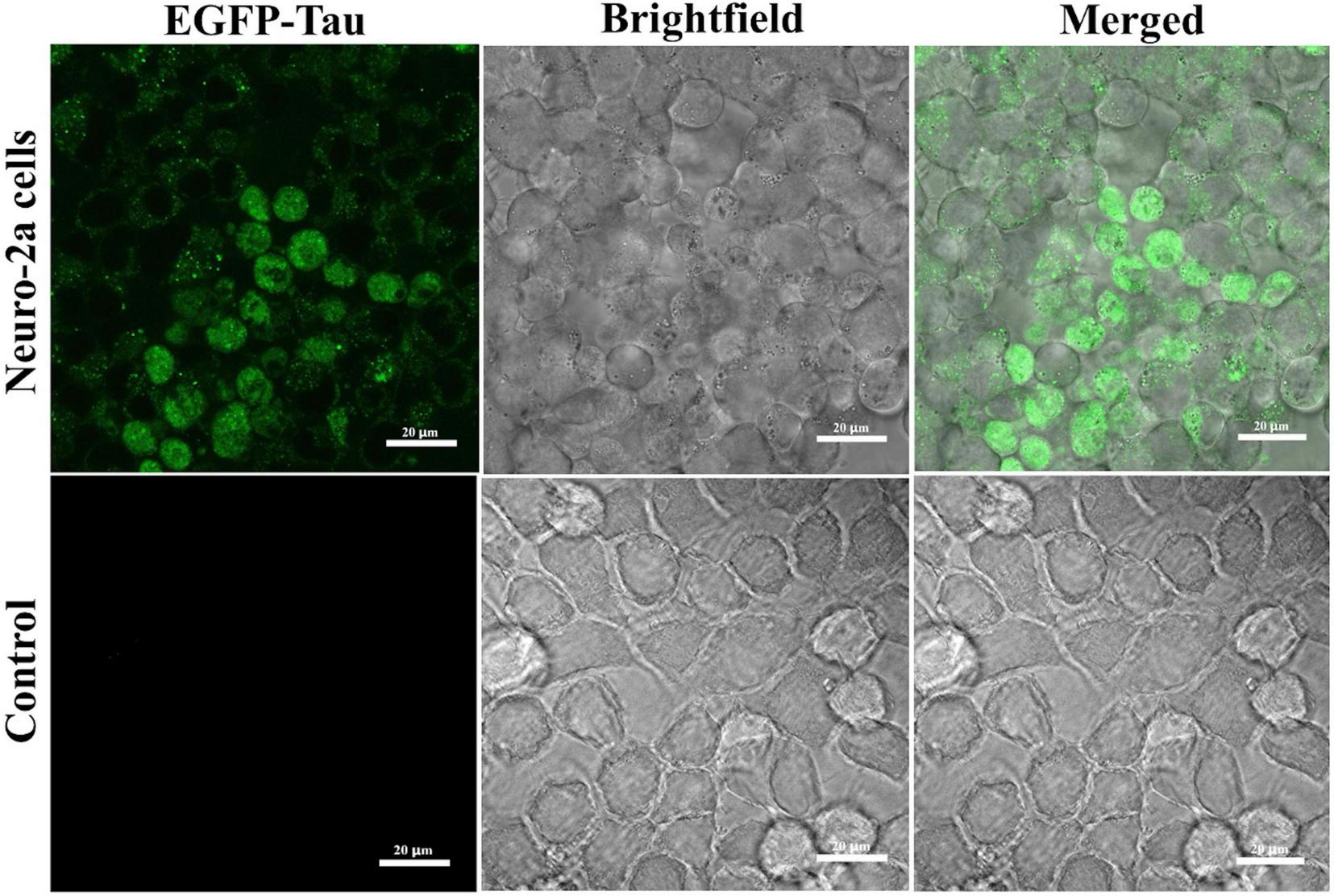 Confocal microscopy images show Neuro-2a cells. The top row displays EGFP-Tau expression: green fluorescence, brightfield, and a merged image, highlighting localization of tau protein within the Neuro-2a cells. The bottom row shows control cells: all dark under fluorescence, brightfield, and merged views, demonstrating no green signal. Scale bars indicate twenty micrometers.