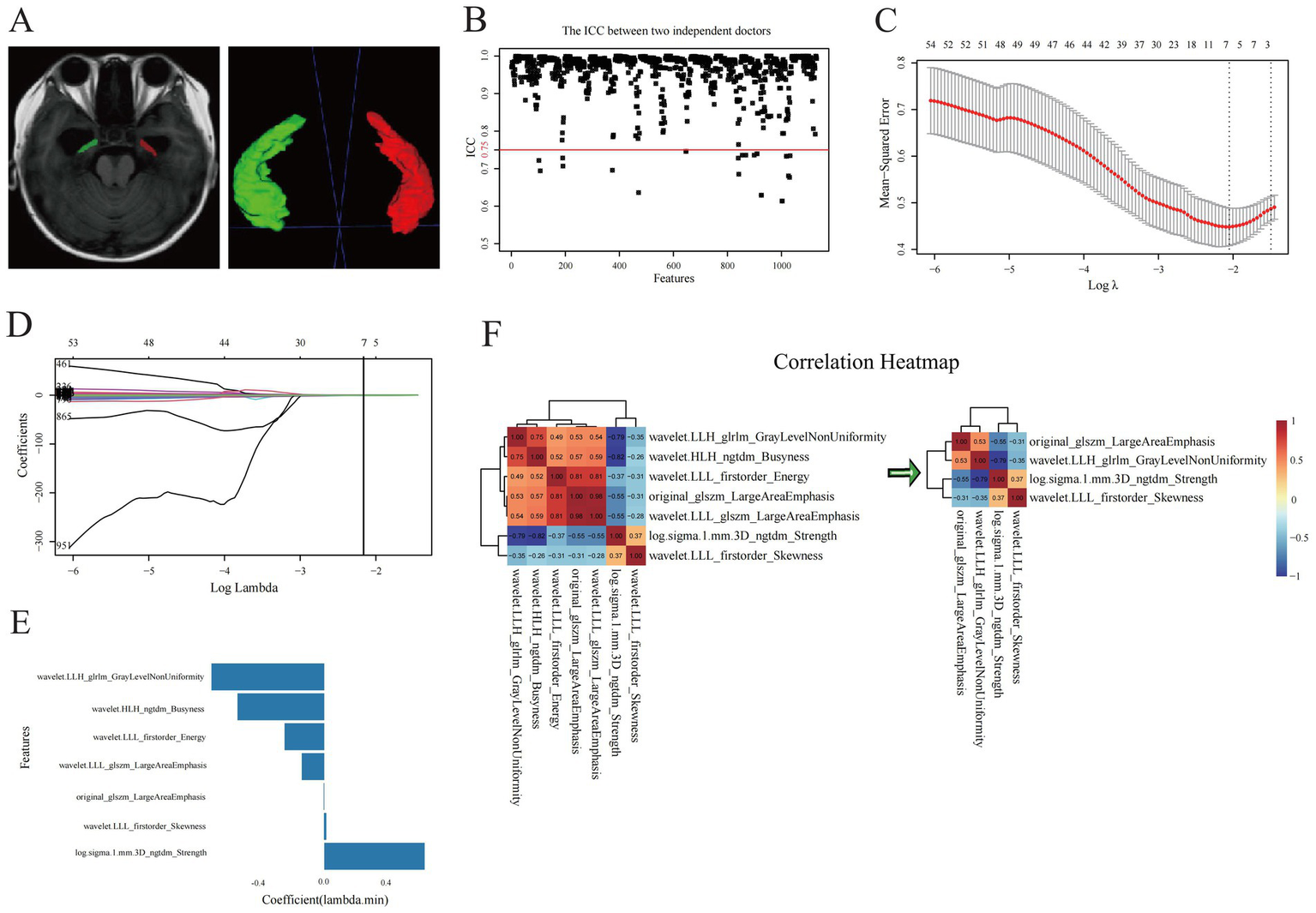 Panel A shows an axial brain MRI with segmented areas in red and green. Panel B is a scatter plot of ICC values, indicating agreement between two doctors across features. Panel C is a plot of mean-squared error versus log(lambda), showing a curve and confidence intervals. Panel D displays coefficients over log(lambda) in a line graph. Panel E features a bar graph of coefficient values for various features. Panel F is a correlation heatmap with color-coding from -1 to 1 to indicate relationships between features.