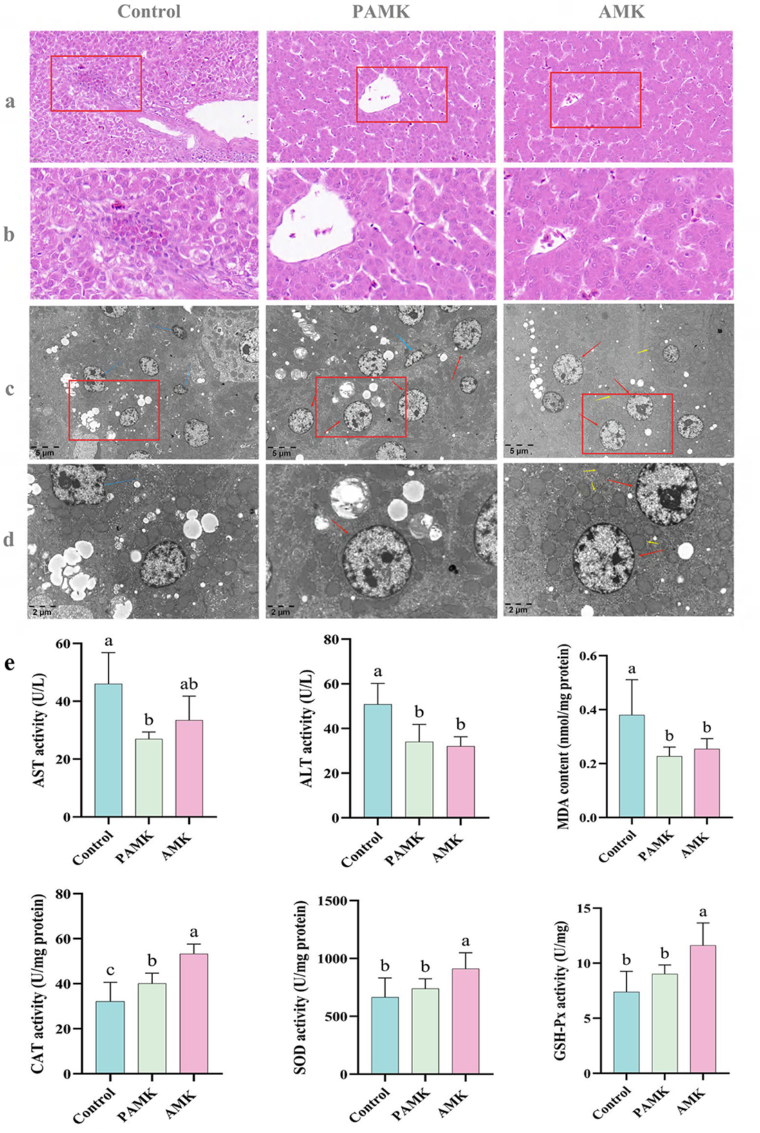Histological and electron microscopy images of liver tissues under control, PAMK, and AMK conditions show cell morphology. Graphs display enzyme activities: AST, ALT, MDA, CAT, SOD, and GSH-Px across these conditions, highlighting variations in activity levels.
