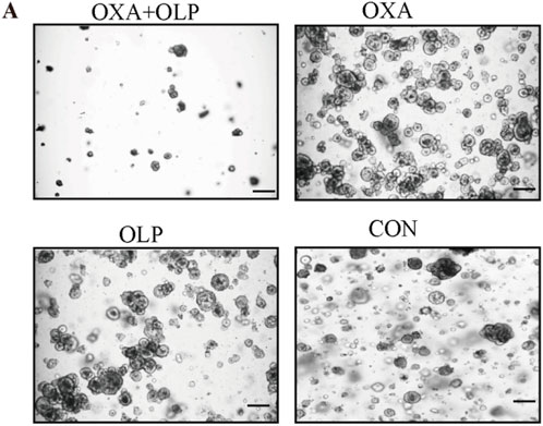 Four microscopic images comparing different conditions. Top left: OXA+OLP, with sparse scattered particles. Top right: OXA, showing abundant clustered particles. Bottom left: OLP, with moderate clustering. Bottom right: CON, displaying randomly distributed particles. Each panel has a scale bar.