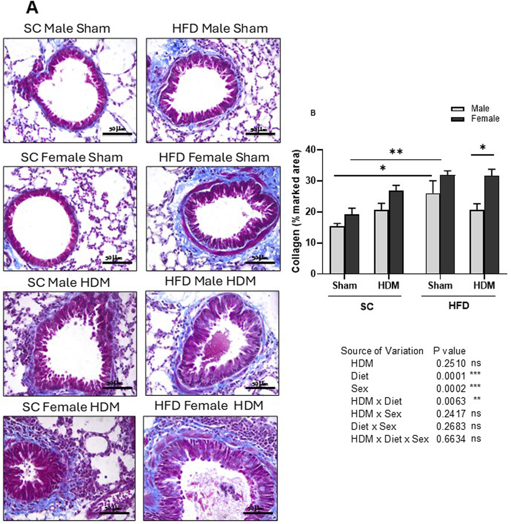 Histological analysis of Masson’s trichrome stained lung tissue of male and female C57Bl/6 mice fed for 13 weeks with SC or HFD diet. Peri bronchial collagen deposition was measured as percentage of marked area analysing 4-6 images per animal. Representative images of all groups (A) and quantification of the deposition (B). The values presented are expressed as Mean ± SEM. In accordance with the data distribution, tests for outlier exclusion were performed using the ROUT test with a Q-value of 1%. Subsequently, a three-way ANOVA followed by the Tukey post-hoc test. N = 4 mice/group, 4–6 random fields/mouse. The differences are visually represented as follows: *p < 0.01; **p < 0.001.