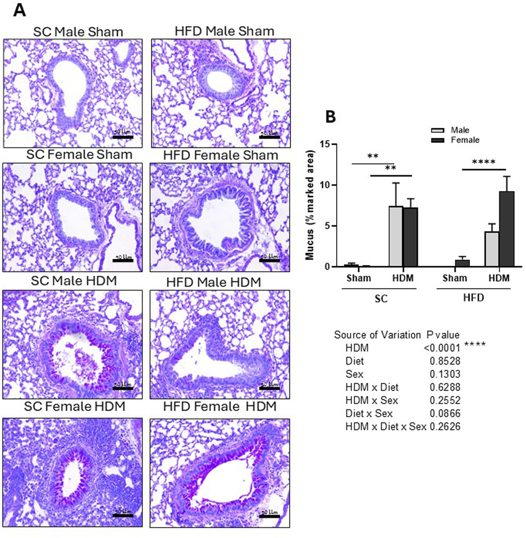 Histological analysis of Periodic acid–Schiff-stained lung tissue of male and female C57Bl/6 mice fed for 13 weeks with SC or HFD diet. Mucus accumulation was measured as percentage of marked area analysing 4–6 images per animal. Representative images of all groups (A) and quantification of the deposition (B). The values presented are expressed as Mean ± SEM. In accordance with the data distribution, tests for outlier exclusion were performed using the ROUT test with a Q-value of 1%. Subsequently, a three-way ANOVA followed by the Tukey post-hoc test. N = 6-8 mice/group. The differences are visually represented as follows: **p < 0.001; ****p < 0.0001.