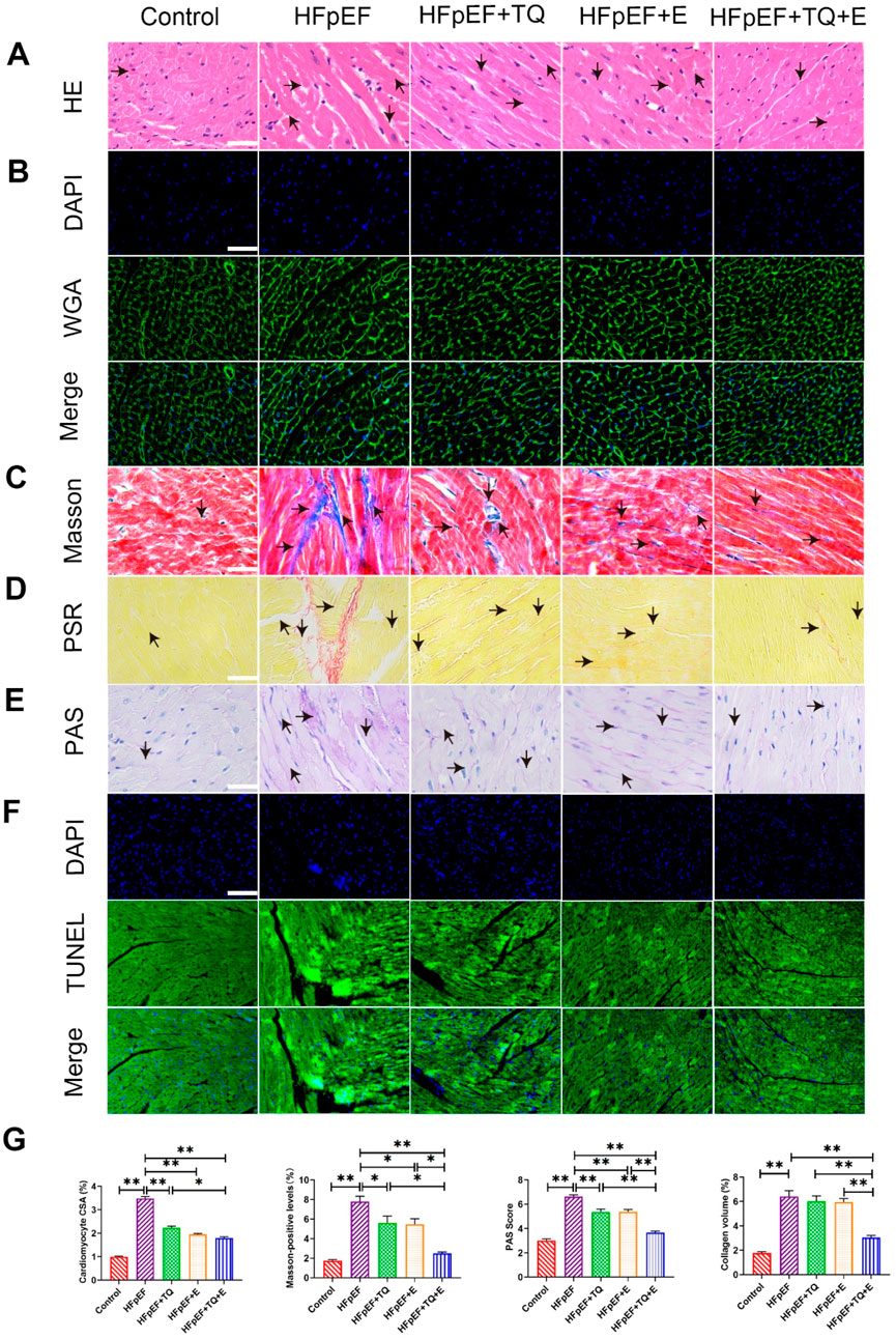 Histological images depicting various staining techniques (HE, DAPI, WGA, and more) are arranged in columns across different groups: Control, HFpEF, HFpEF+TQ, HFpEF+E, HFpEF+TQ+E. Arrows indicate key features in each section. A bar graph below shows quantification analyses, such as cardiomyocyte area and collagen volume, with statistical significance indicated by asterisks.