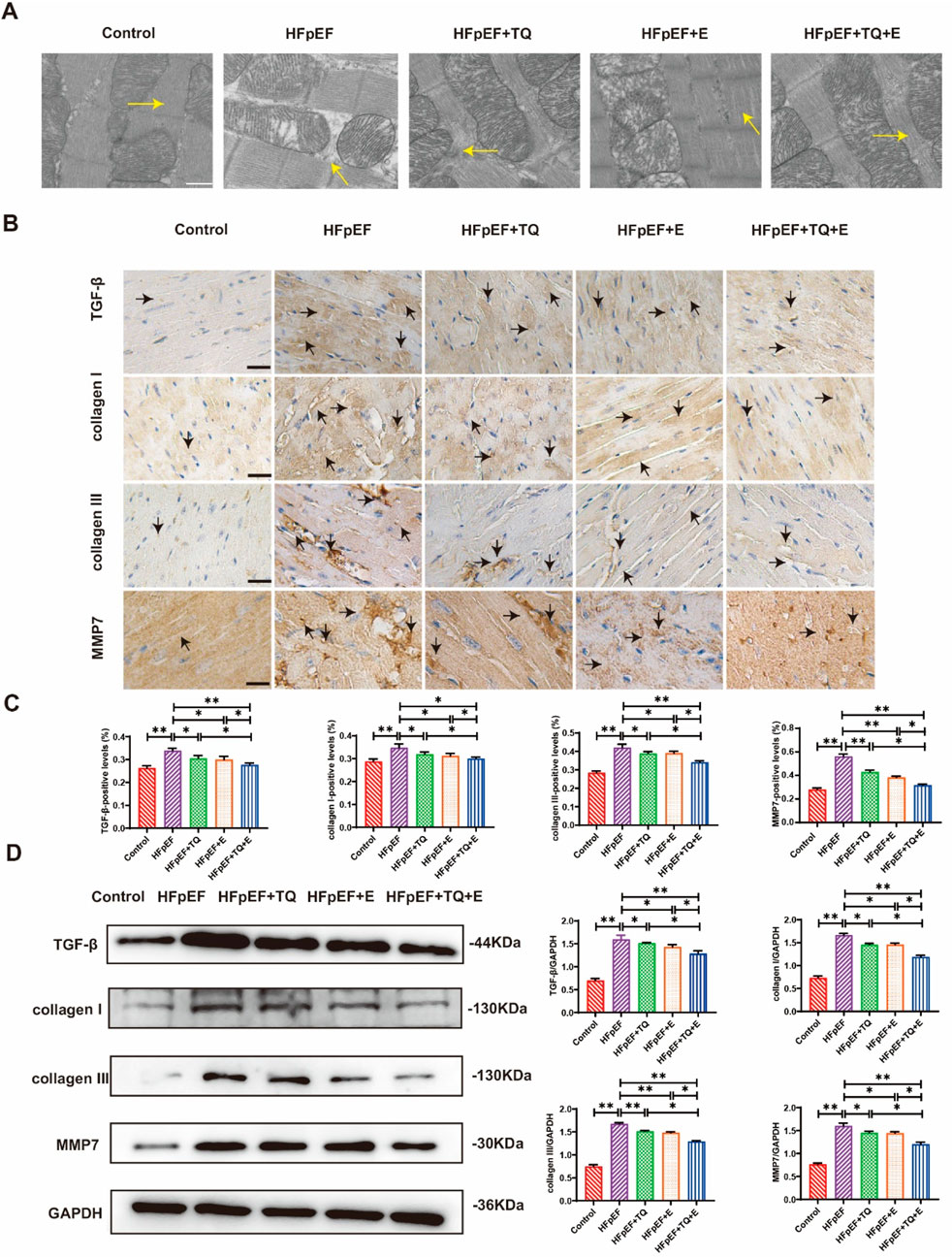 (A) Microscopic images showing tissue structure under different conditions with yellow arrows indicating specific features. (B) Histological images demonstrate expression levels of TGF-β, collagen I, collagen III, and MMP7 in tissues, marked with arrows. (C) Bar graphs compare percentages of positive tissue fibers for TGF-β, collagen I, collagen III, and MMP7 across different treatment groups, noting statistical significance. (D) Western blot analysis displays protein levels of TGF-β, collagen I, collagen III, MMP7, and GAPDH, with corresponding bar graphs showing quantification and significance of changes among groups.