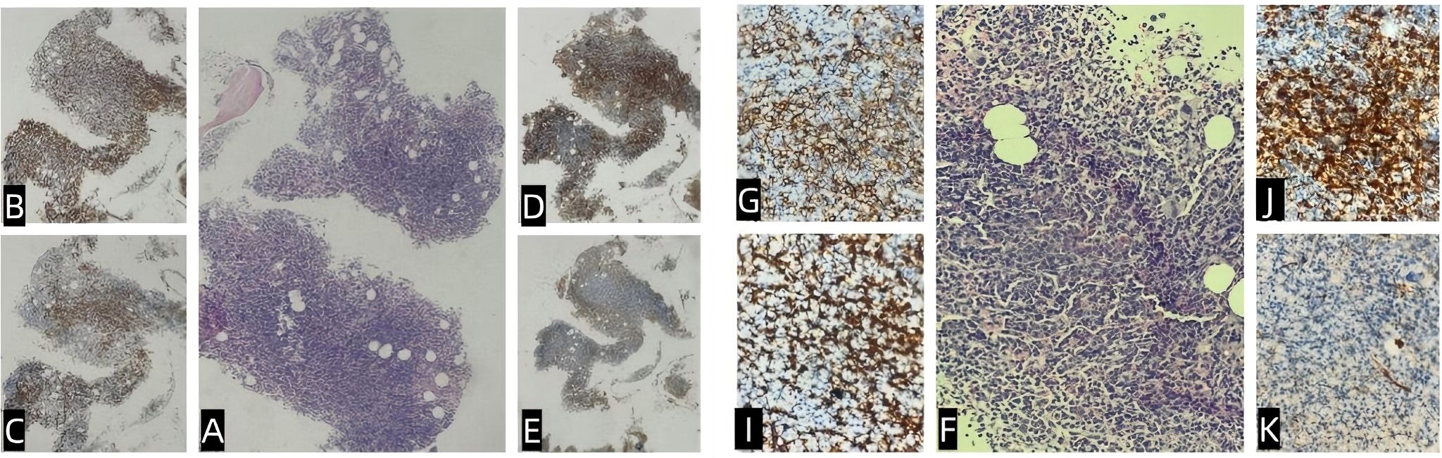 Microscopic images show various tissue samples labeled from A to K. Each panel displays cellular structures with different staining patterns, indicating distinct histological features. Backgrounds are mostly light-colored, providing contrast to the stained areas.