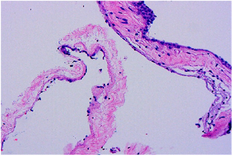 Microscopic image of lung tissue showing pink-stained, elongated structures with scattered dark spots representing cell nuclei. The tissue exhibits a wavy, folded pattern, indicative of histological analysis.