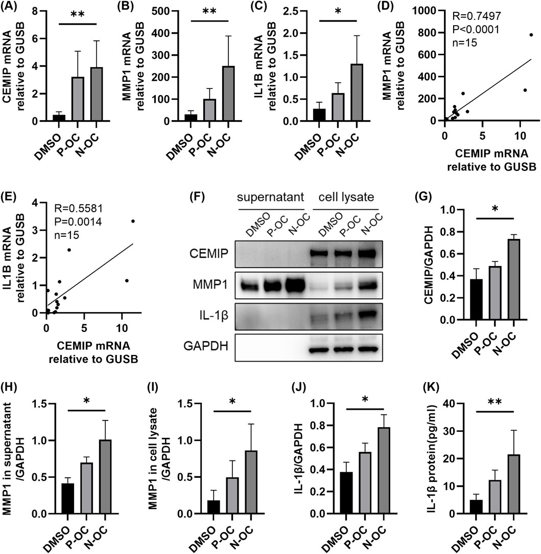 Bar graphs, scatter plots, and a Western blot demonstrate mRNA and protein expressions. Panels (A) to (E) show significant differences in CEMIP, MMP1, and IL1B expression levels across DMSO, P-OC, and N-OC treatments. Panel (D) and (E) include correlation graphs. Panel (F) presents Western blot bands for CEMIP, MMP1, and IL-1β. Panels (G) to (K) depict quantitative protein analyses. Significant differences are marked with asterisks.